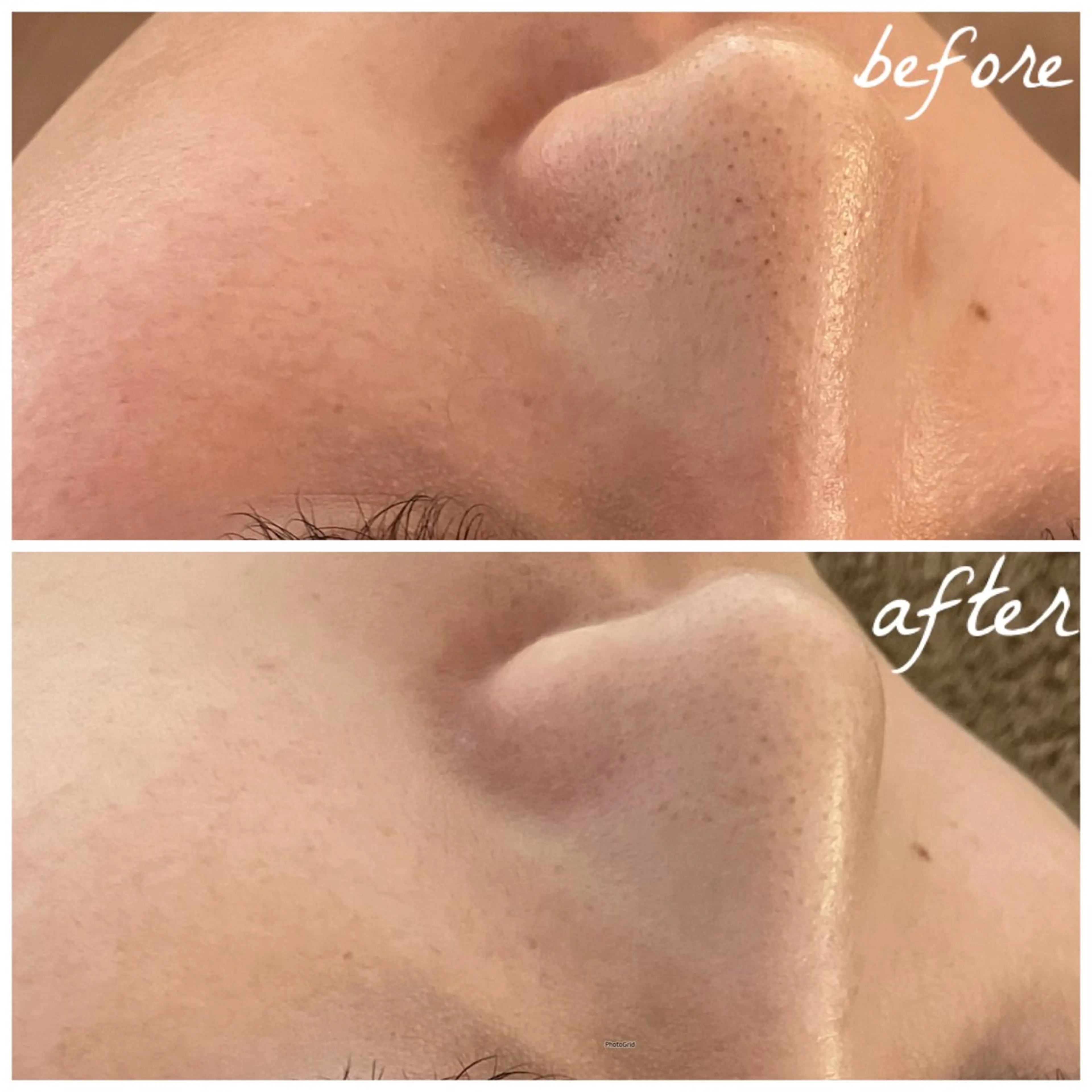 メンズ メナード岐阜茜部 杉浦のエステ・リラクイメージ