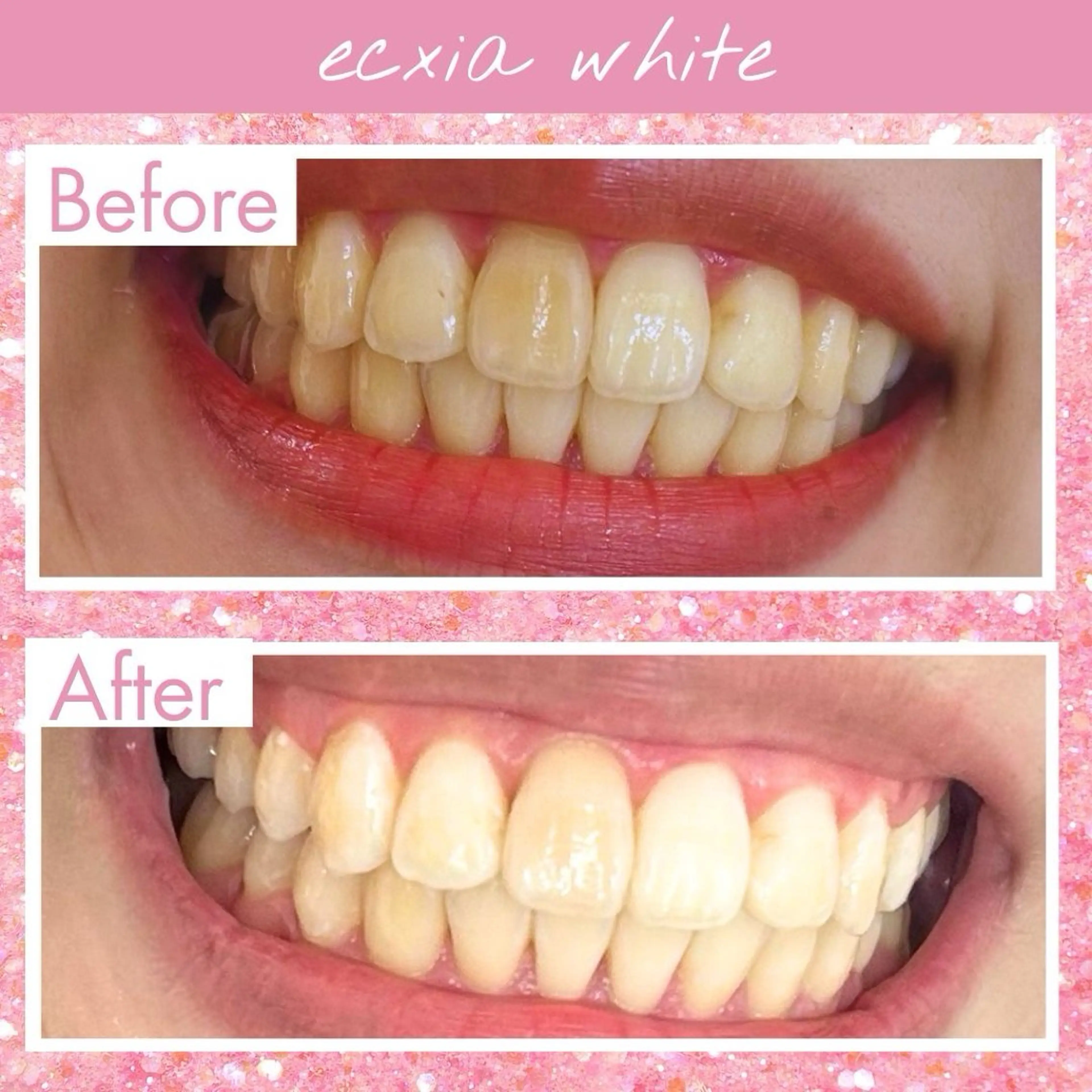 その他 セルフホワイトニング エクシア大府店のその他イメージ