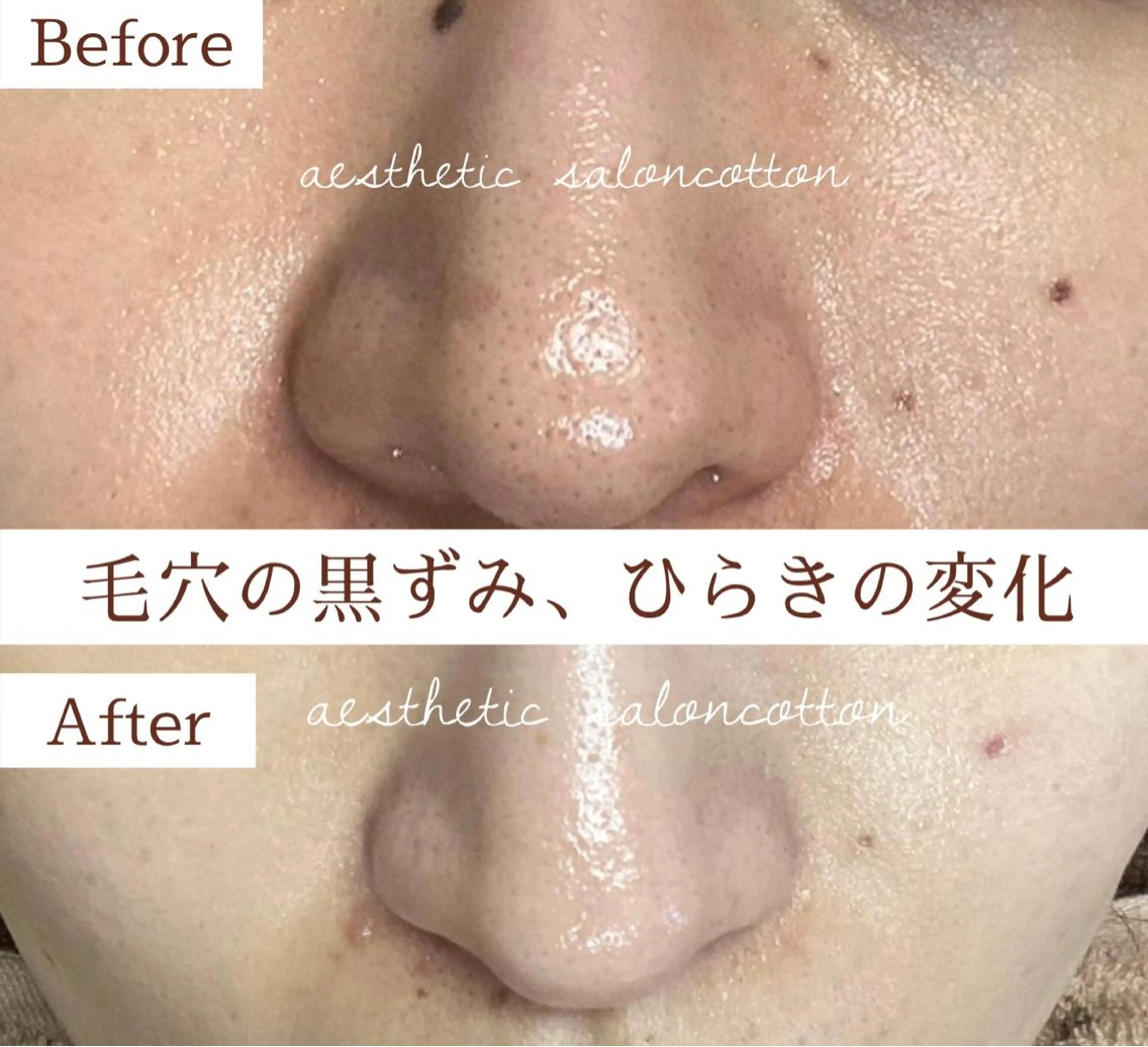 都度払い 肌質改善専門サロンのエステ・リラクイメージ