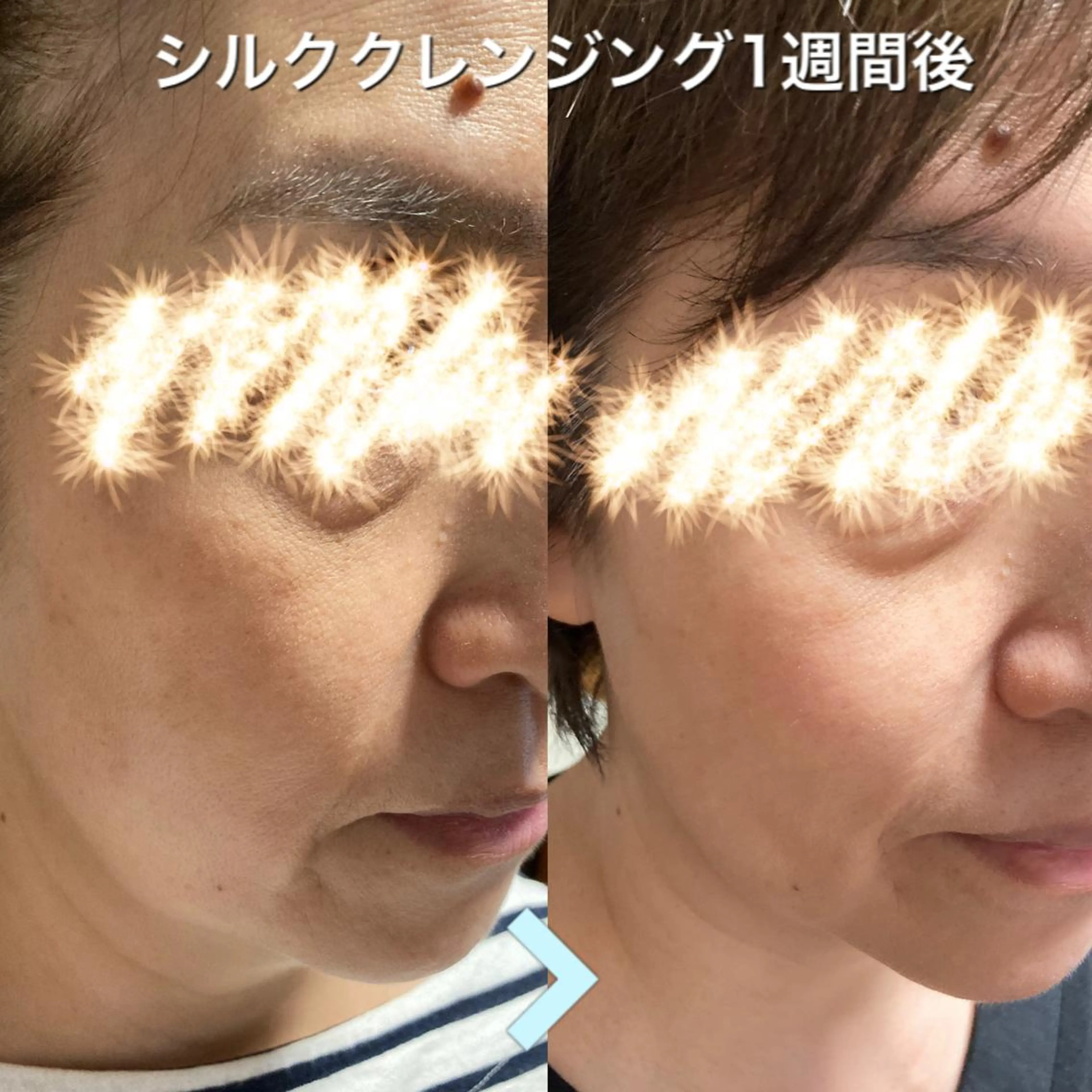 足浴＋シルクエステ＋筋膜施術オーダーメイド60分☆ミニモ限定の組み合わせ！！の写真