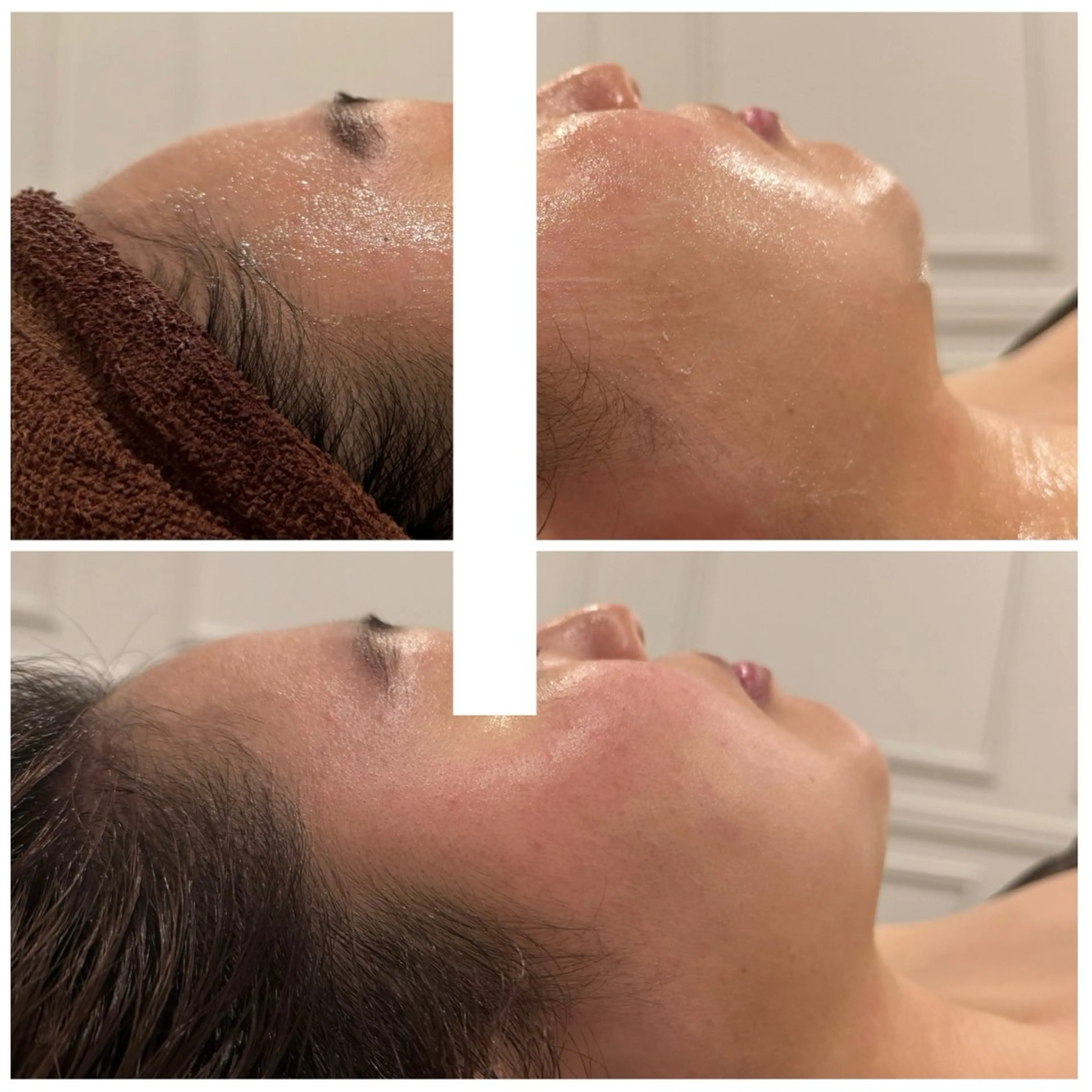 🌟【当日限定🉐フェイシャル】最短結果の小顔ケア❤️痛くない✨コルギマッサージでむくみすっきり✨ヘッドマッサージ付きの写真