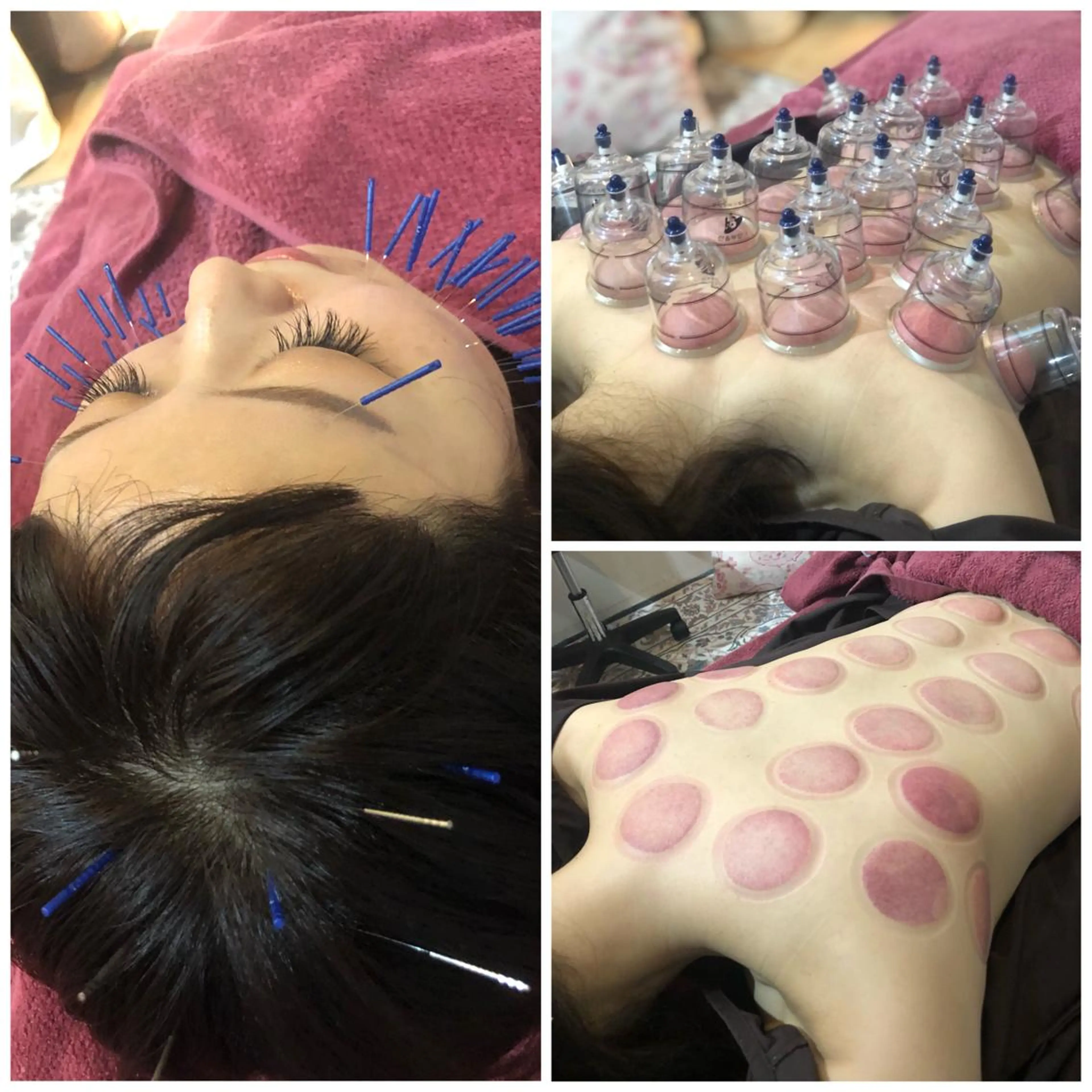 美容鍼灸女性専用 りんご鍼灸治療院のエステ・リラクイメージ