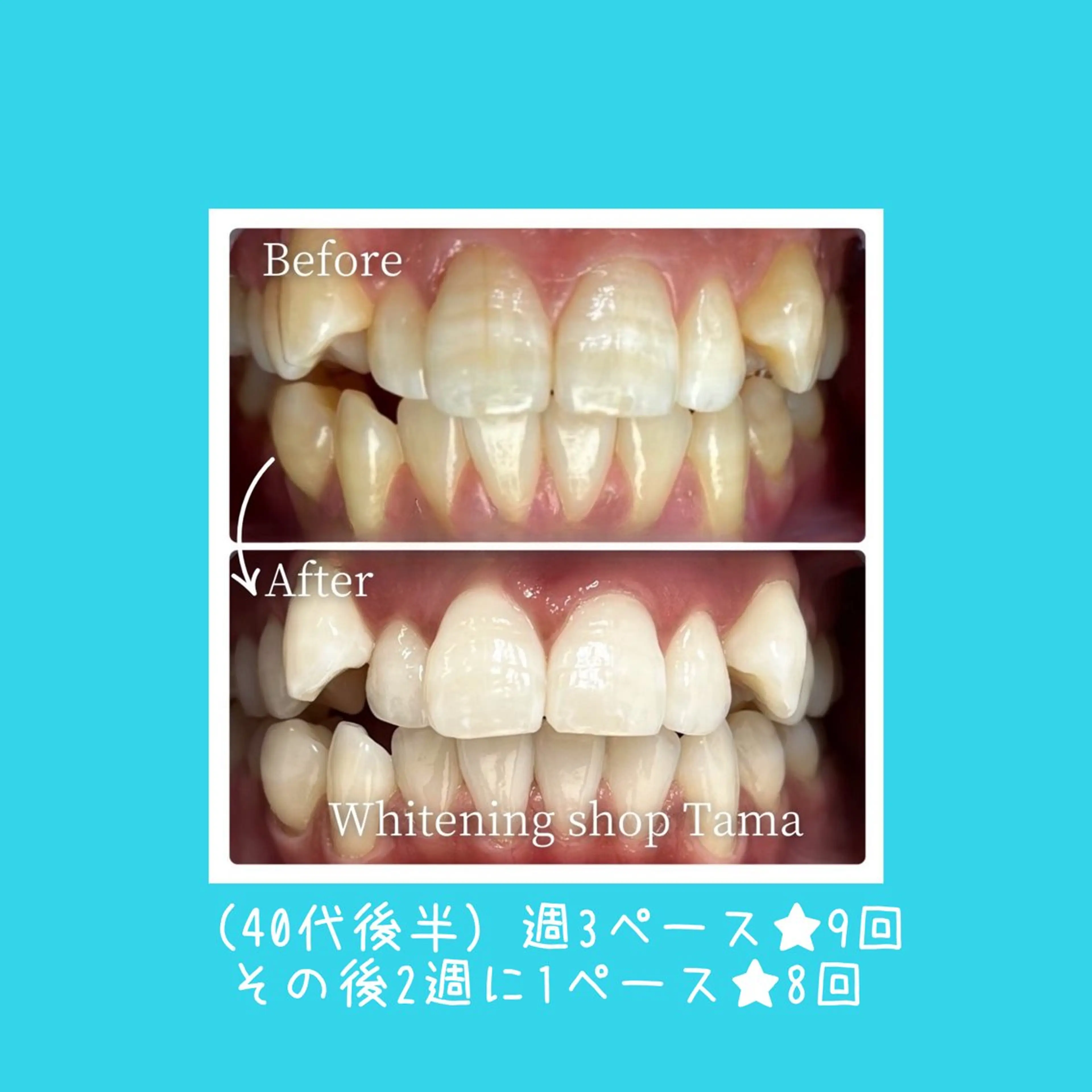 ホワイトニング ショップ多摩店のその他イメージ