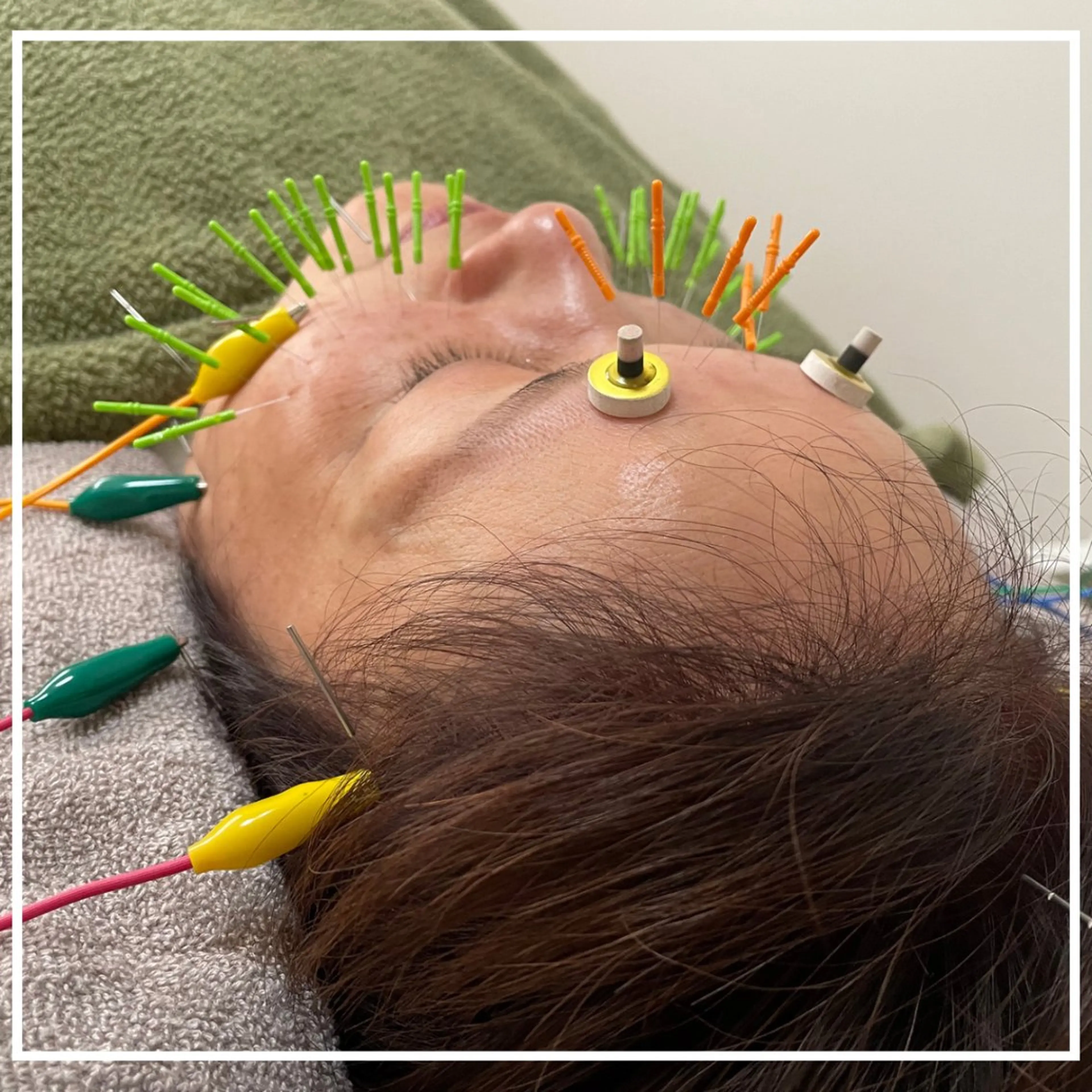 美容鍼灸サロン   colorier所属・美容鍼灸サロン colorierのエステ・リラクイメージ