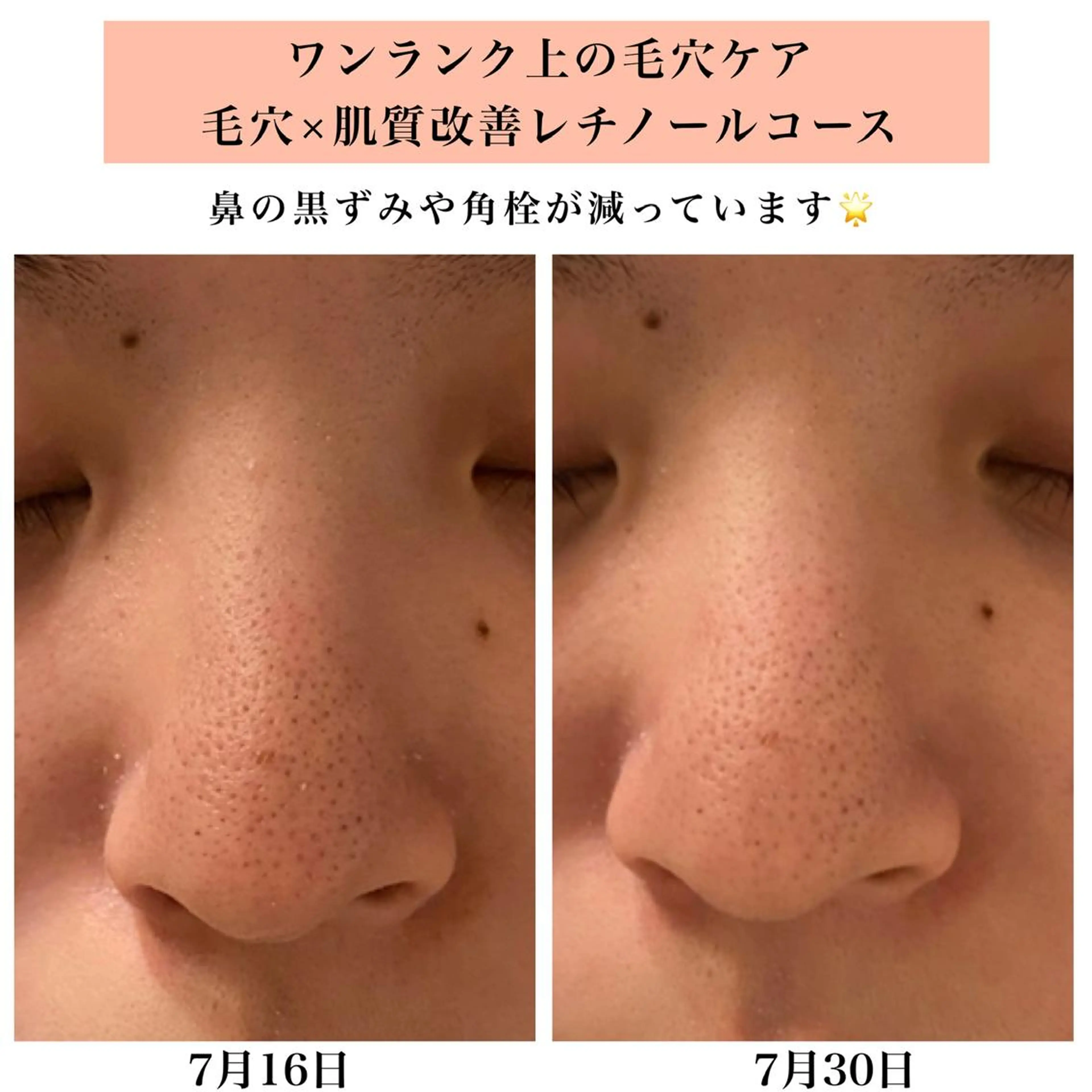 エステ リラク Bellesthe （ベルエステ）のエステ・リラクイメージ