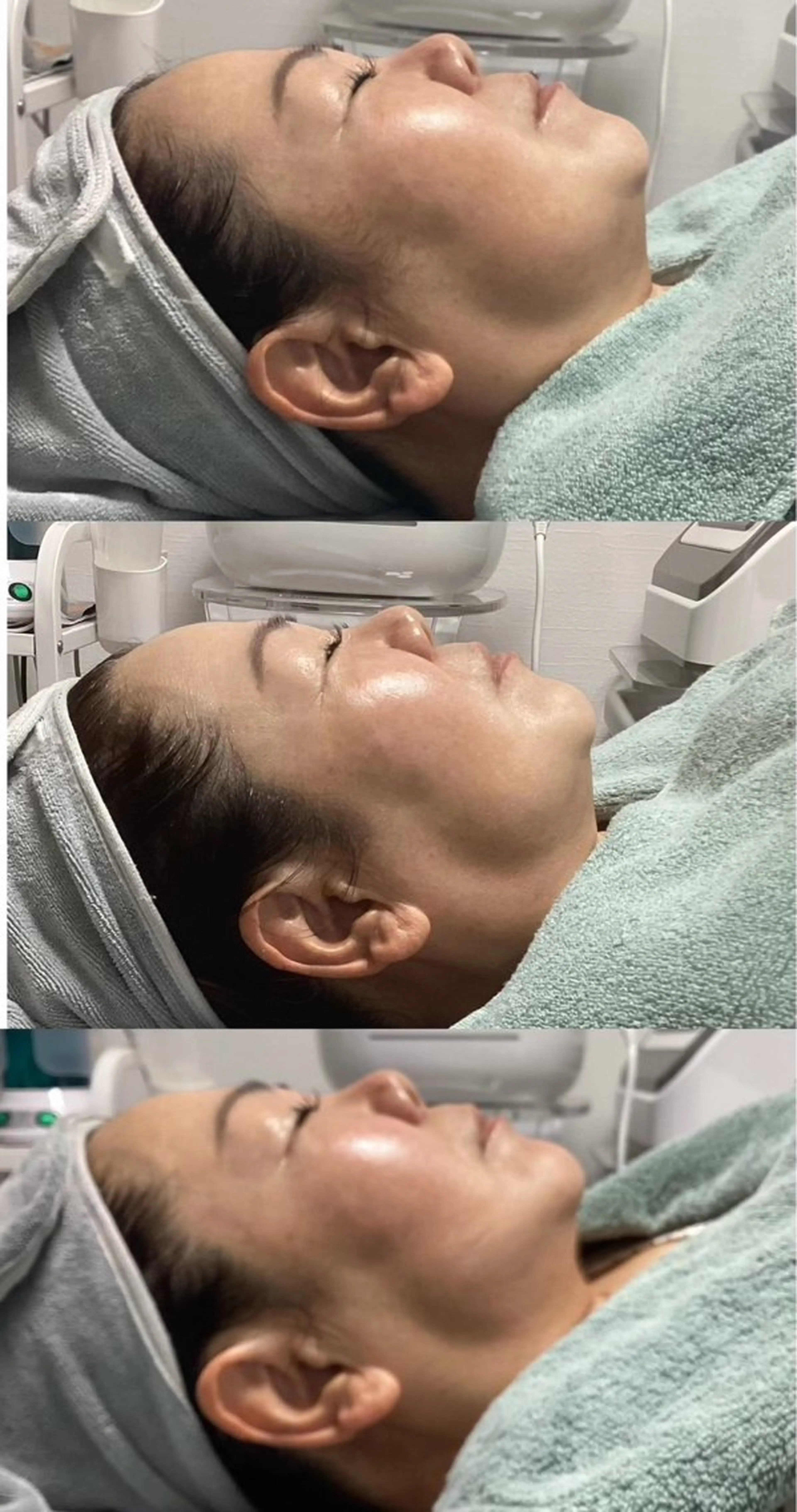 エステ リラク ホワイティアビシェル ウラワ　白澤奇のその他イメージ