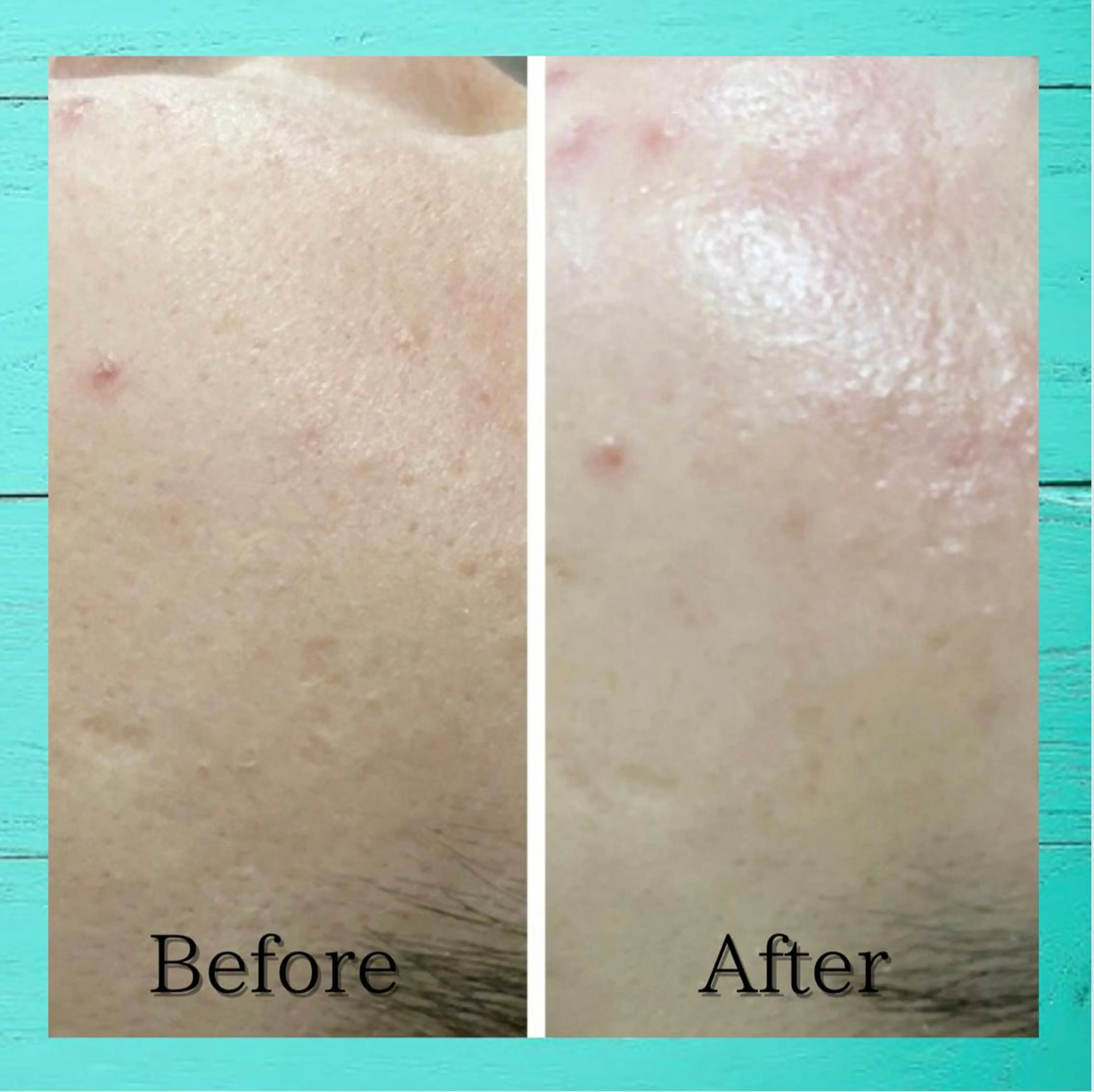 Lumiere despoir所属・Lumiere despoirのエステ・リラクイメージ