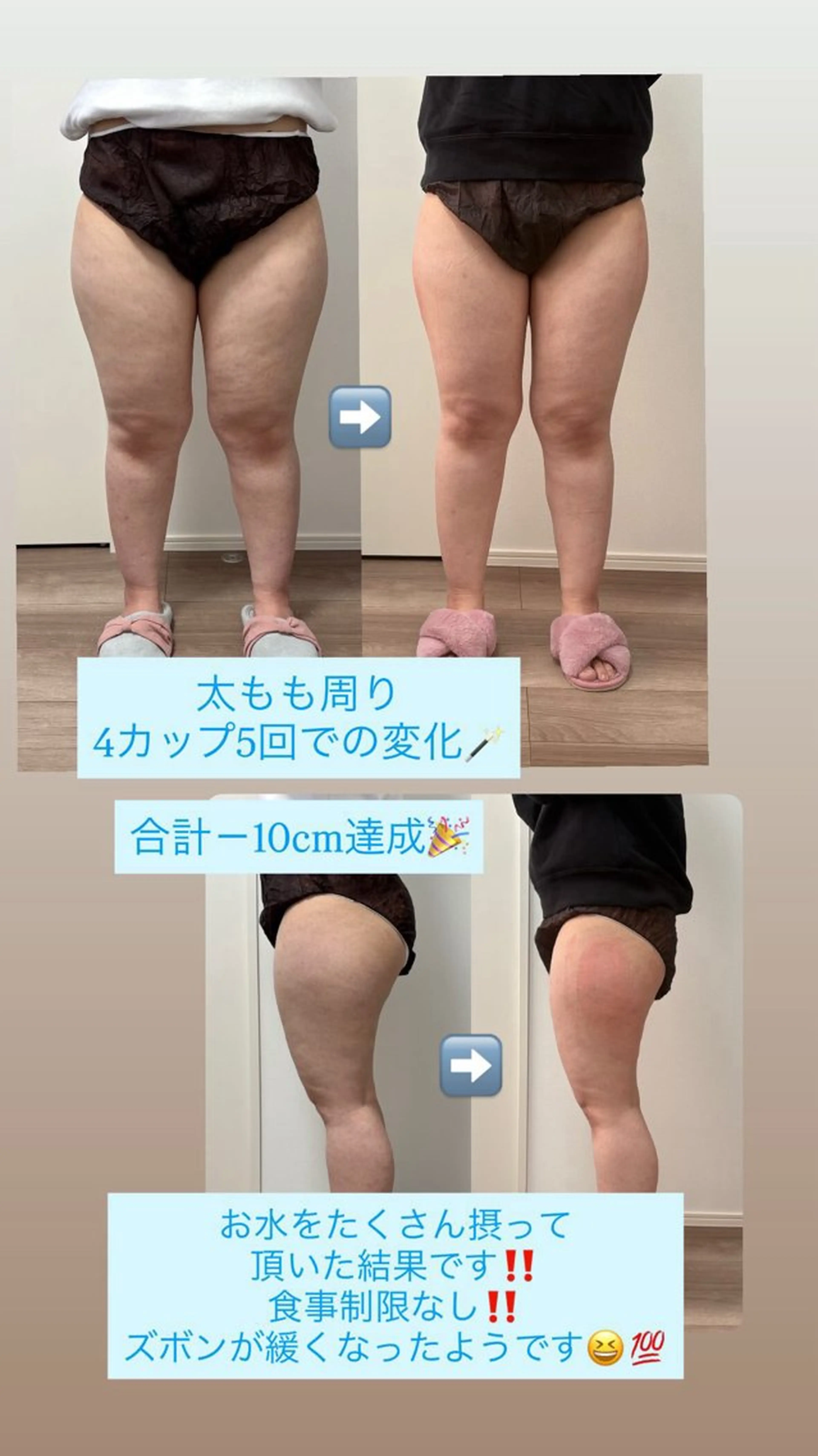 エステ Miiju.所属・Miiju. 石巻市 脂肪冷却  鈴木のエステ・リラクイメージ