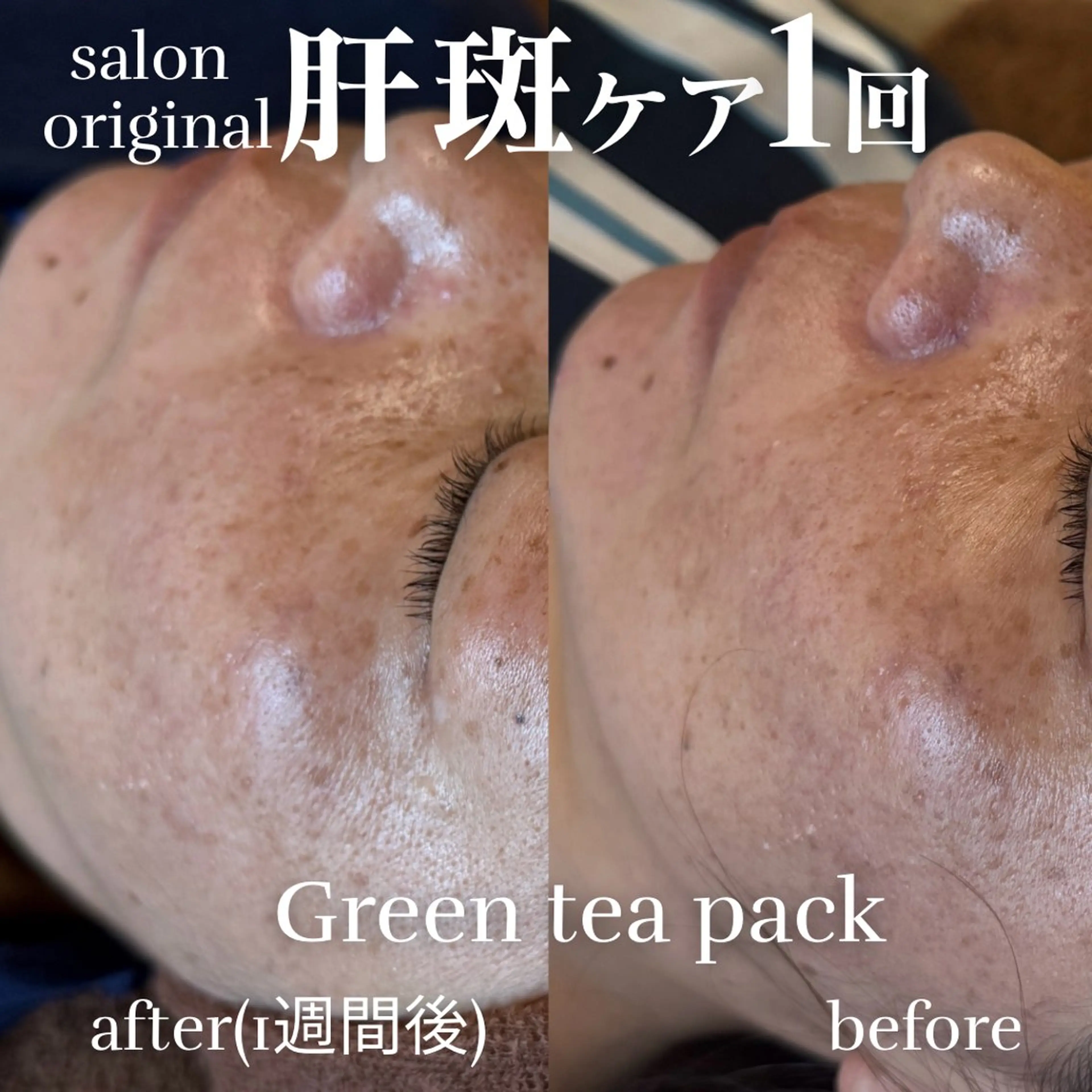 エステ 美肌salon GRAN CUORE所属・Natsuki🌙 GRAN CUOREのエステ・リラクイメージ