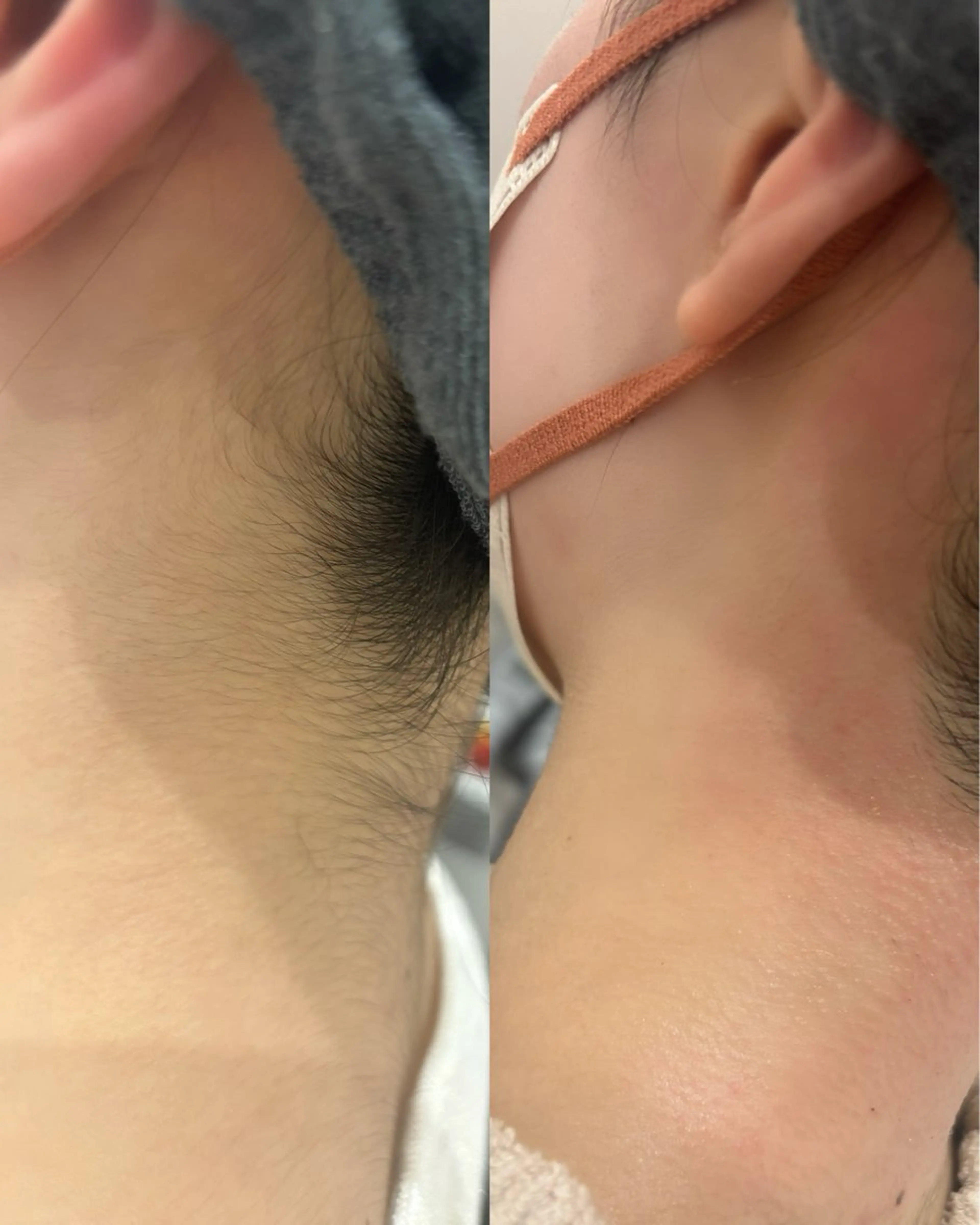 脱毛 melia 岡山駅前店のエステ・リラクイメージ