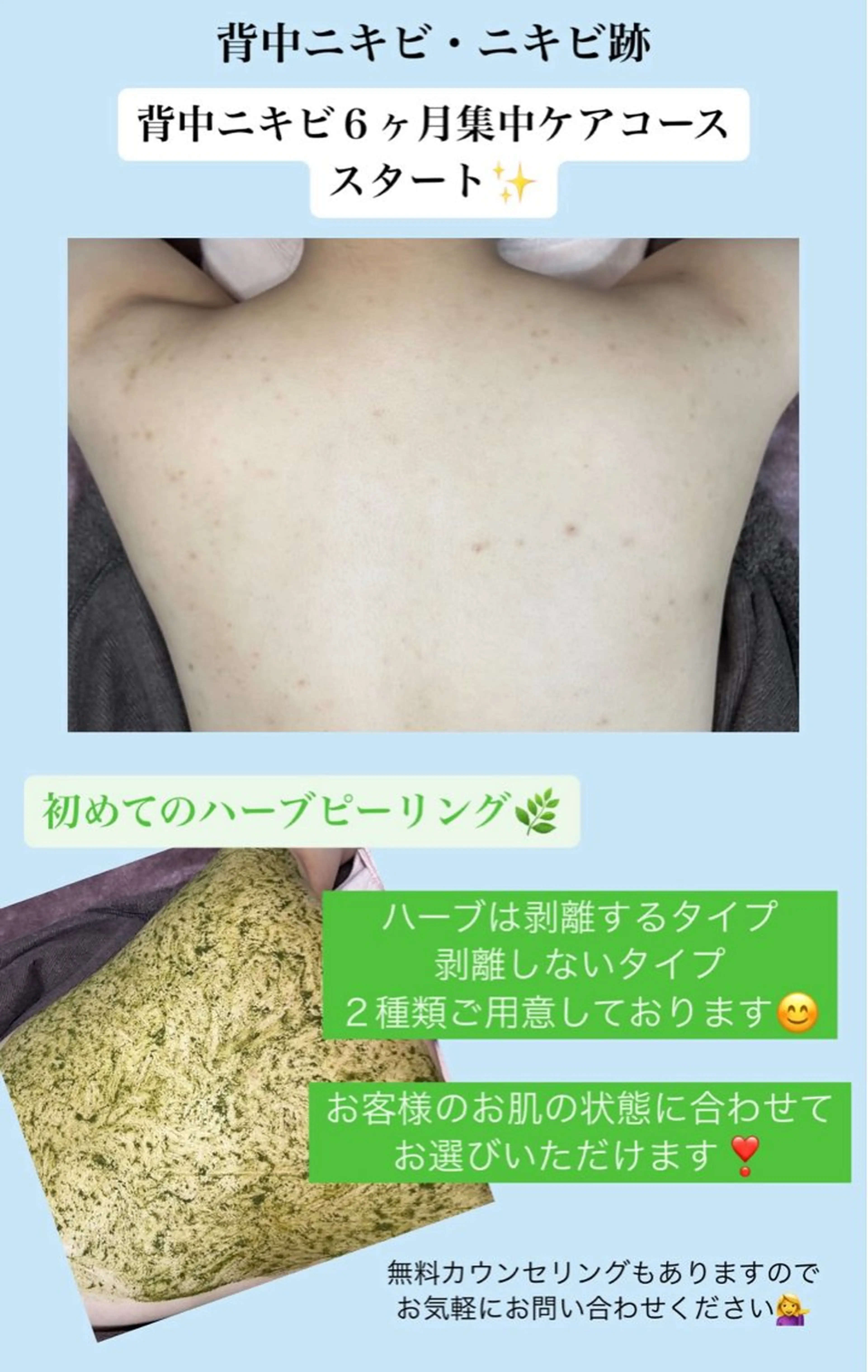 エステ ベラージュ【美背中・ 美尻・フェイシャル】のエステ・リラクイメージ