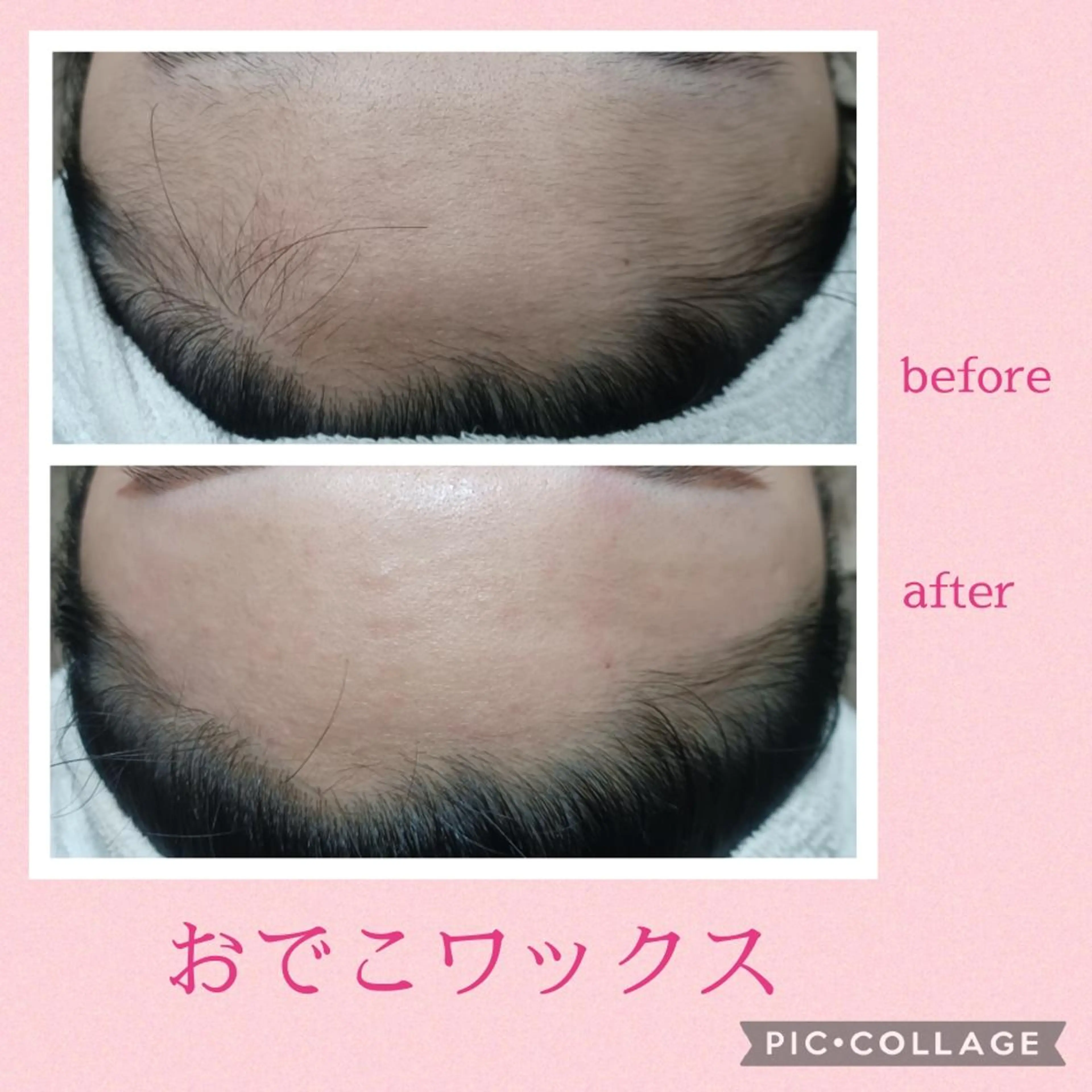 アイブロウ Lutella所属・ワックス脱毛専門店 Lutellaのエステ・リラクイメージ