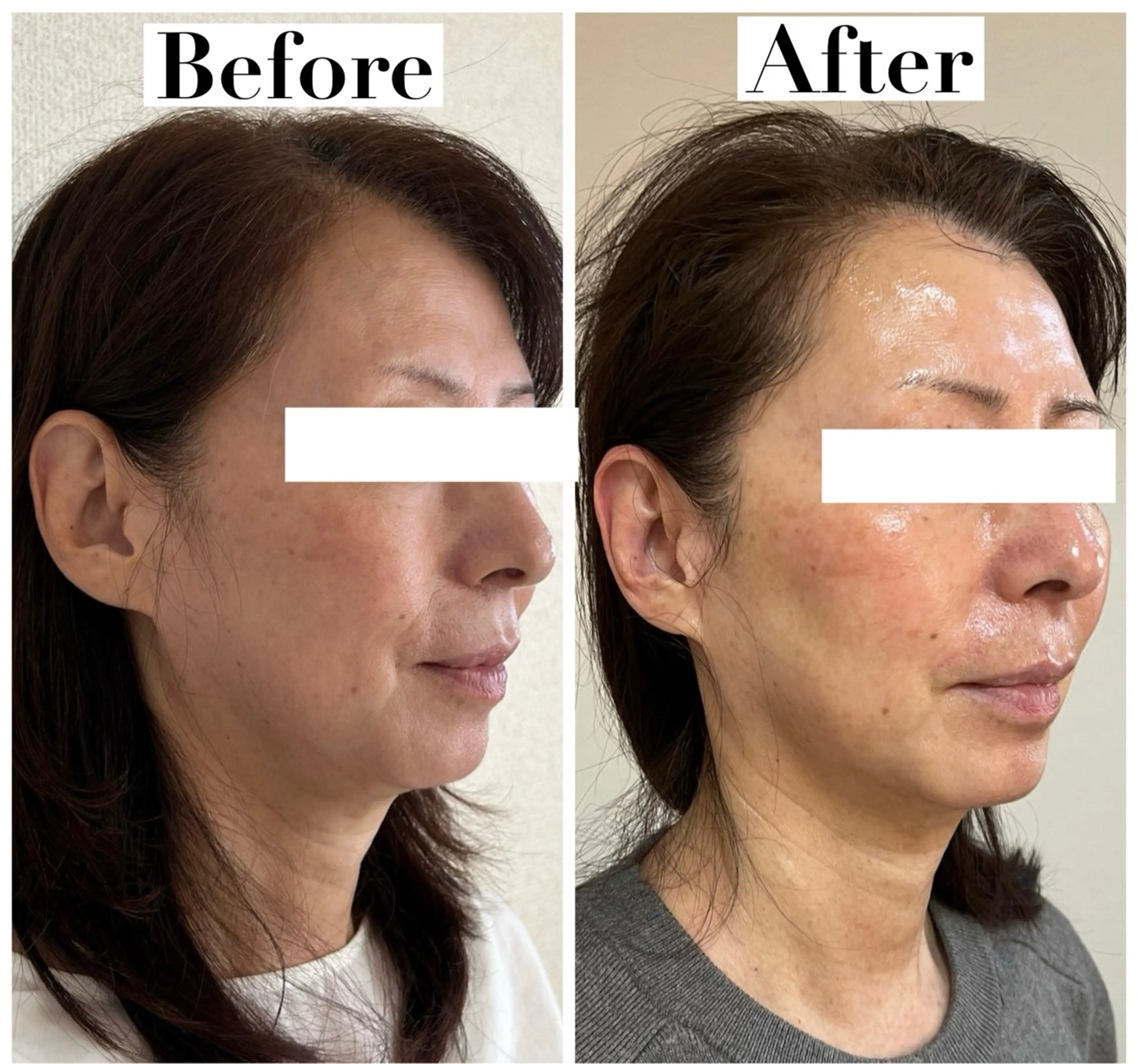 エステ リラク たるみ改善サロン Ｍdesignのエステ・リラクイメージ