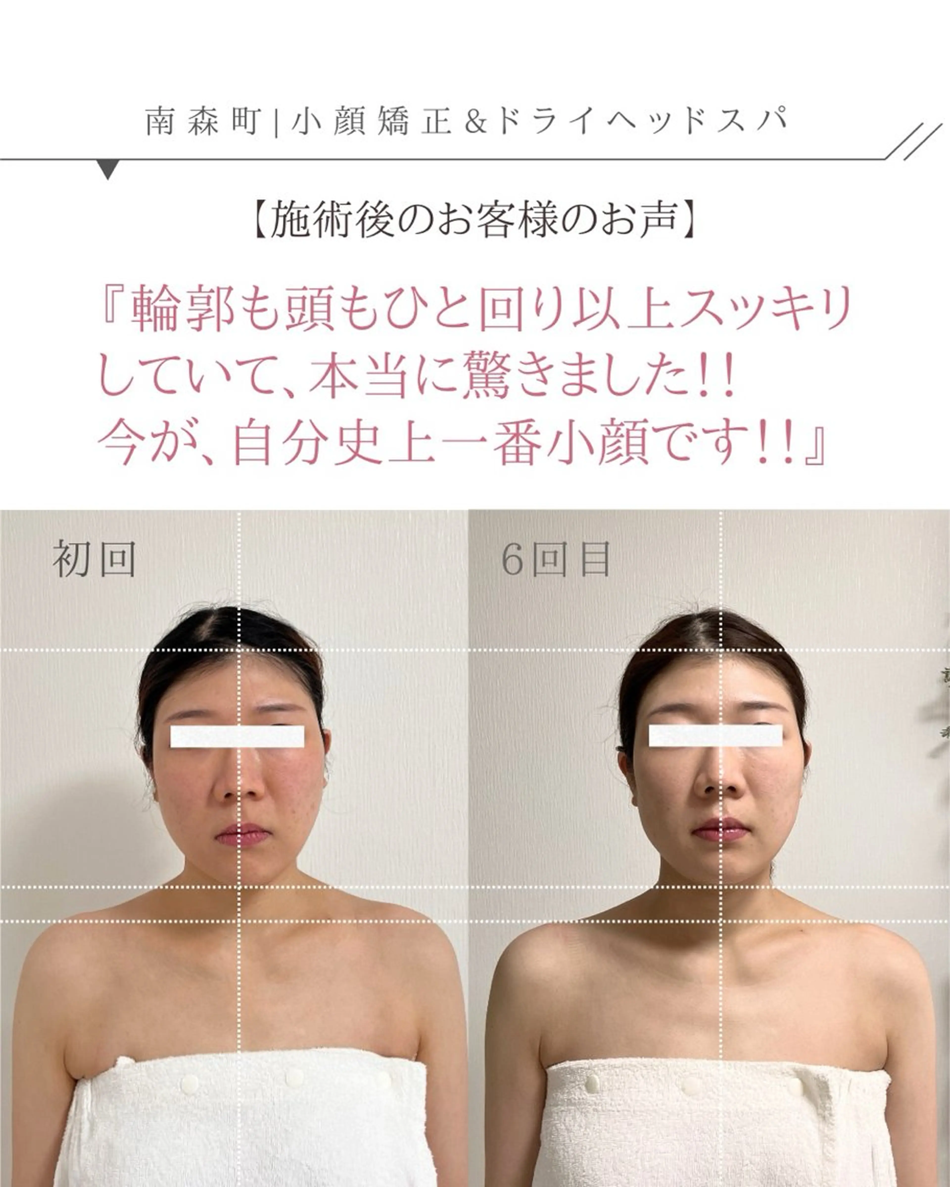 🌿 30代限定 3ヶ月間(6回来店条件)90分【フェイスラインすっきり小顔ヘッドスパ】の写真