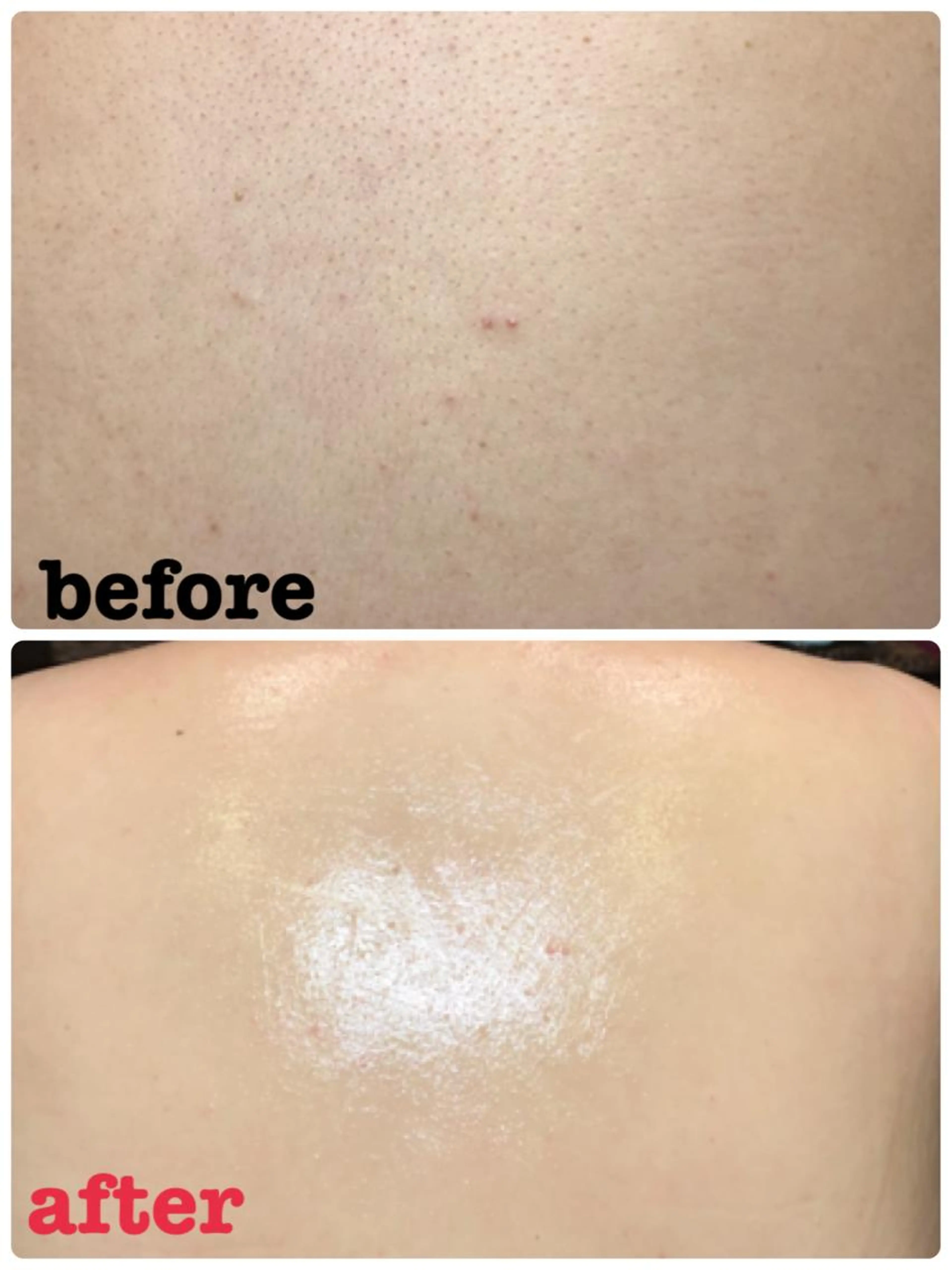 【オススメ文を投稿済みの方限定】✩お背中剃りのみ✩の写真