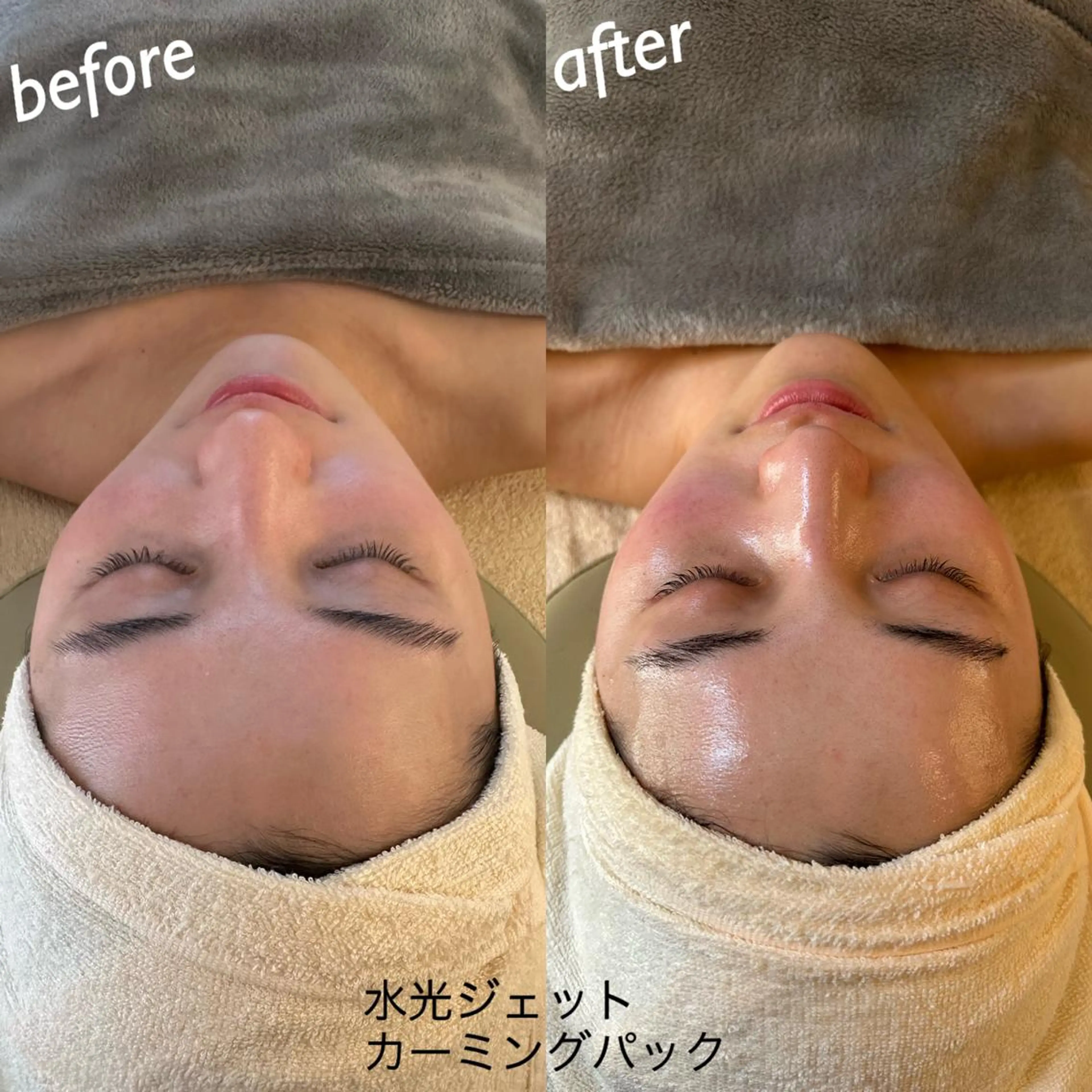 エステ うなじ脱毛/美肌脱毛 LABELのエステ・リラクイメージ