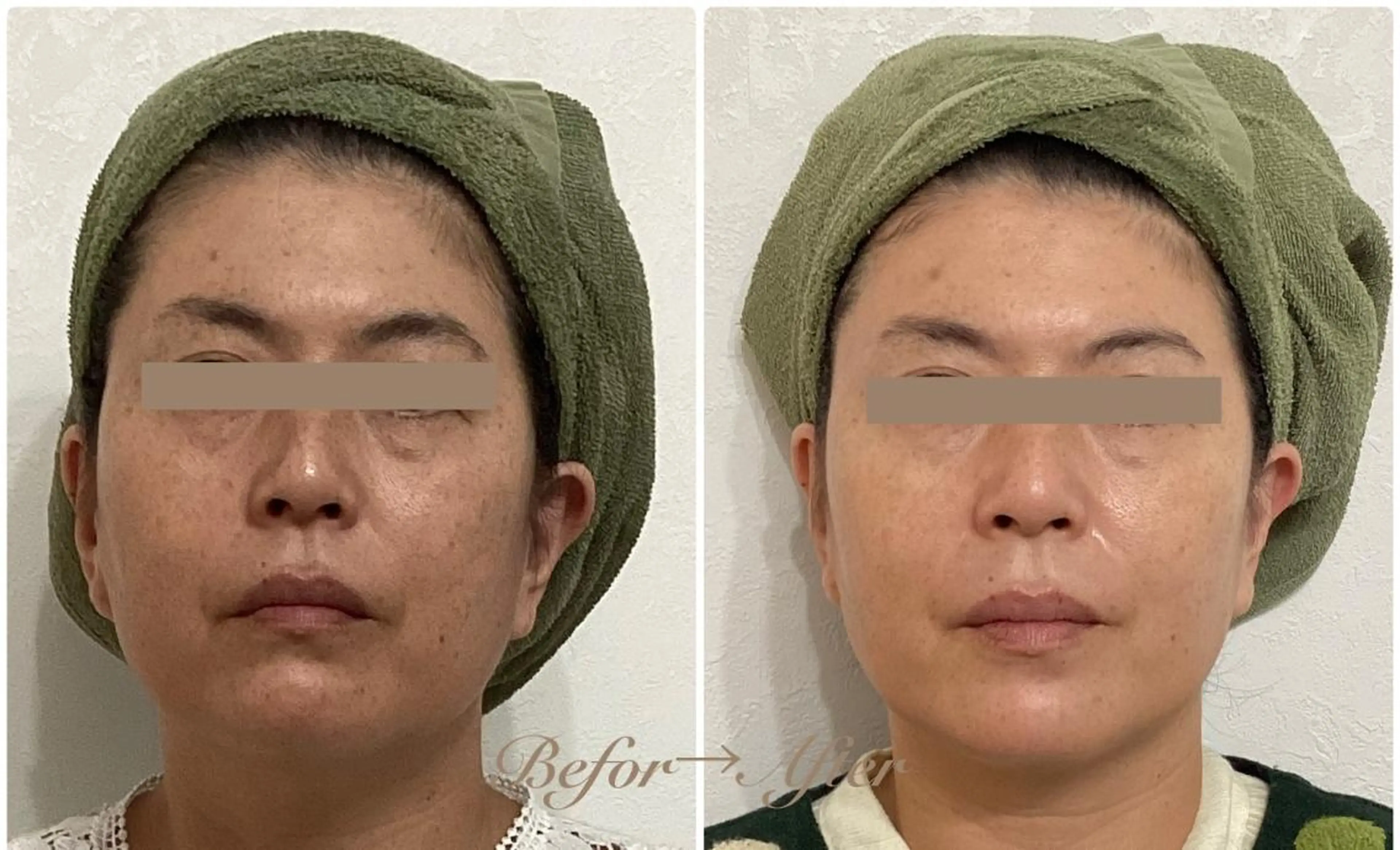 小顔専門店 グレイスボディ三郷店のエステ・リラクイメージ