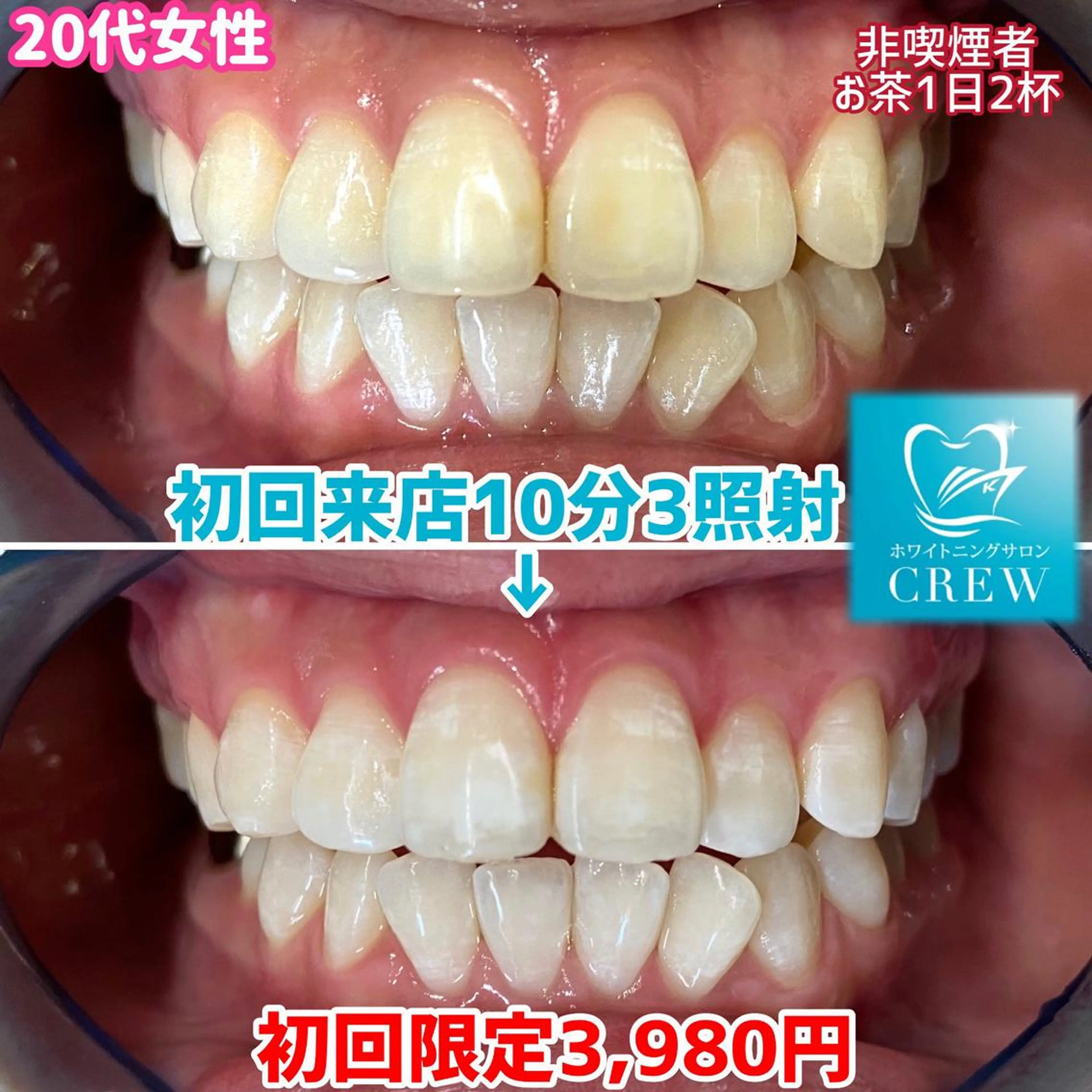 メンズ マツエク・マツパ その他 ホワイトニング ⚓︎CREW柏⚓︎のその他イメージ