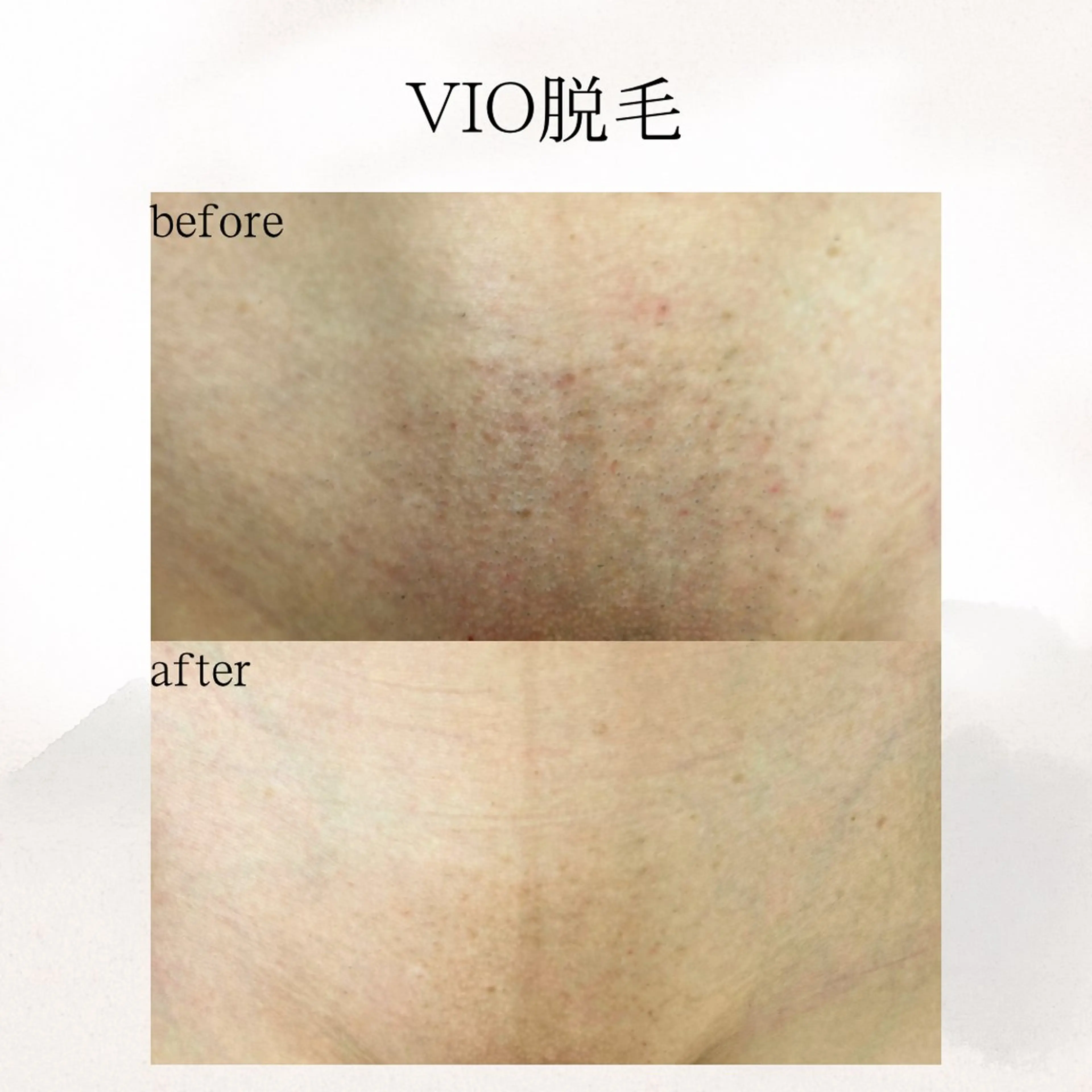 メンズ 歌舞伎町深夜サロン to mëのエステ・リラクイメージ