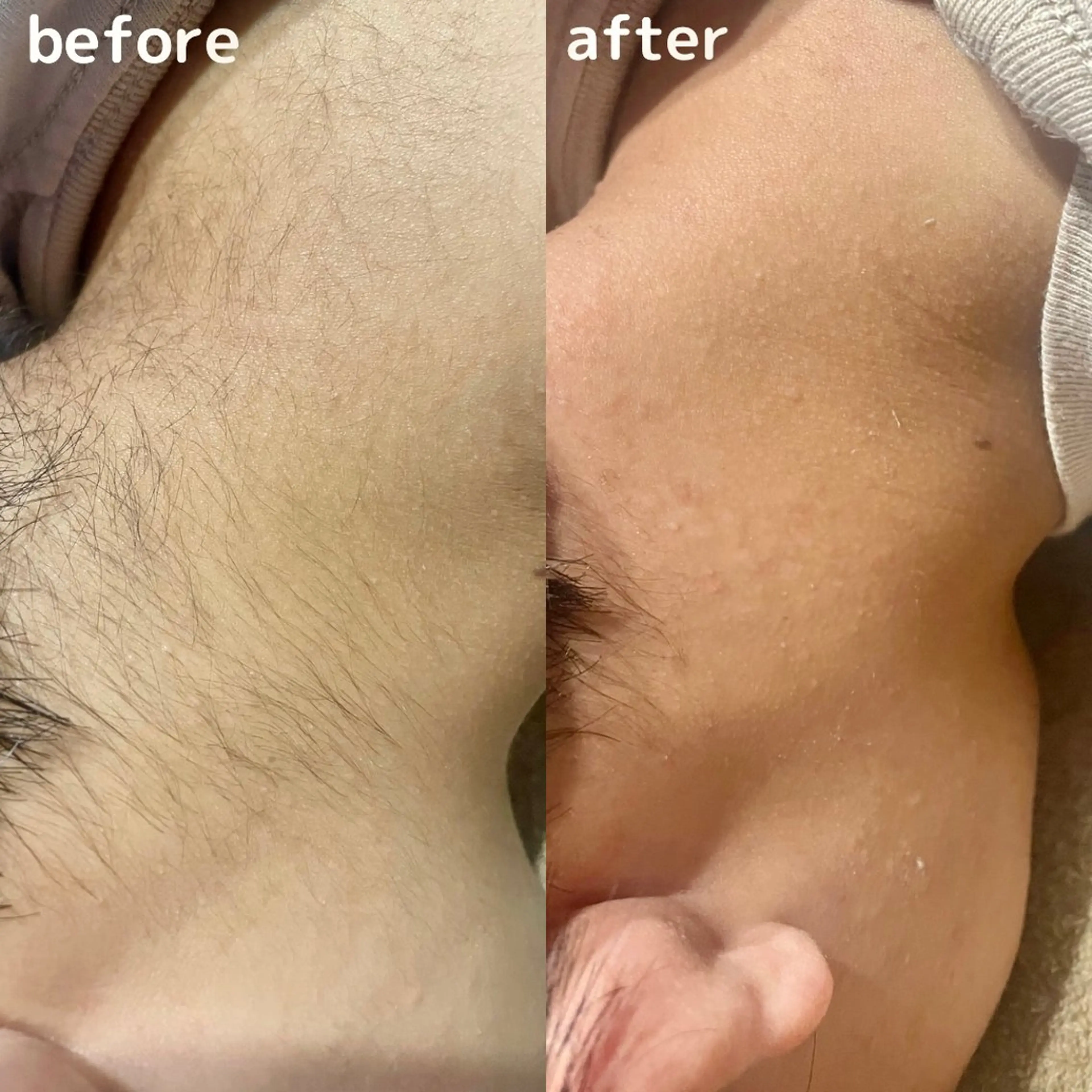 エステ リラク 痩身・フェイシャル/if  byOrabriller所属・if byOrab riller【ｲﾌ】のその他イメージ