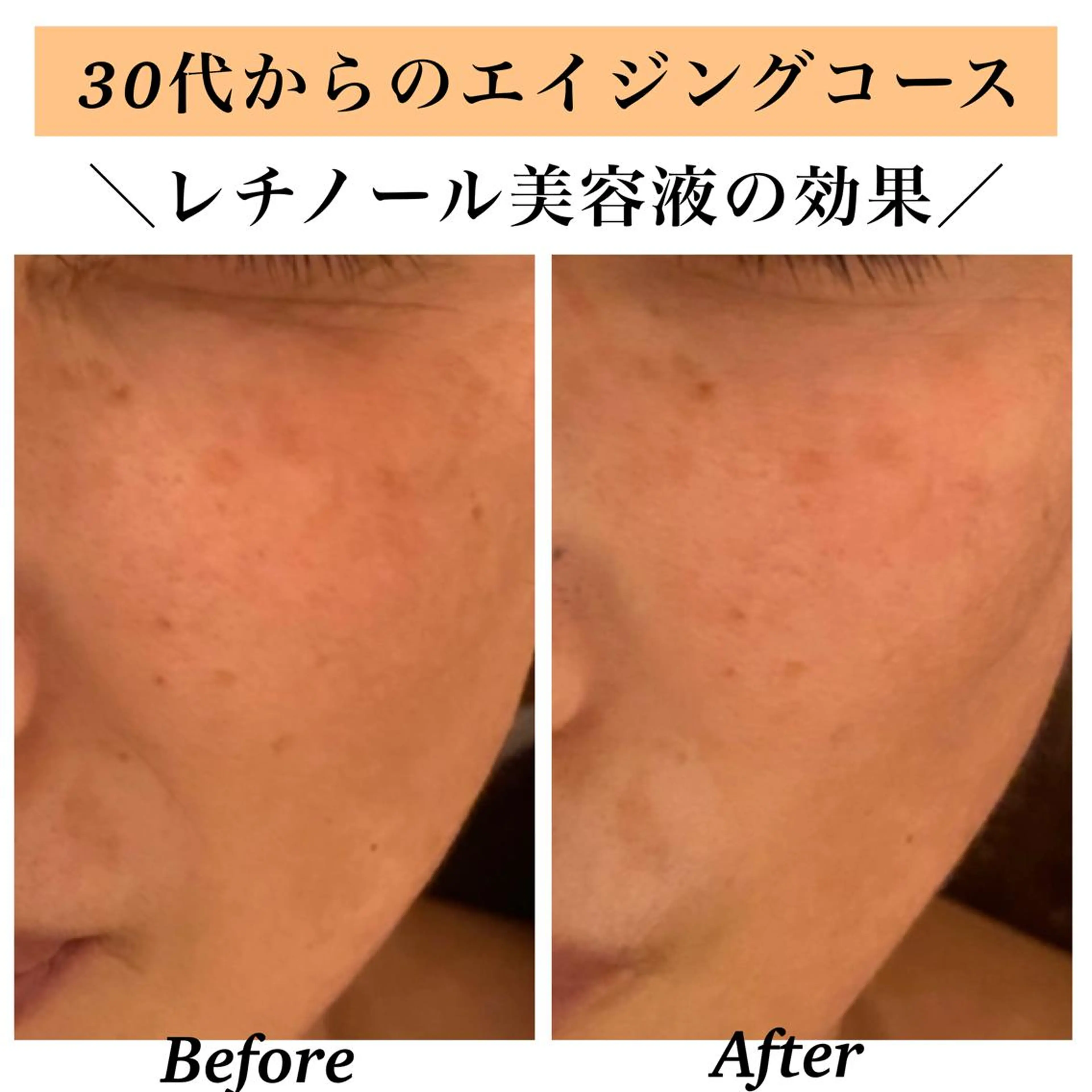 エステ リラク Bellesthe （ベルエステ）のエステ・リラクイメージ