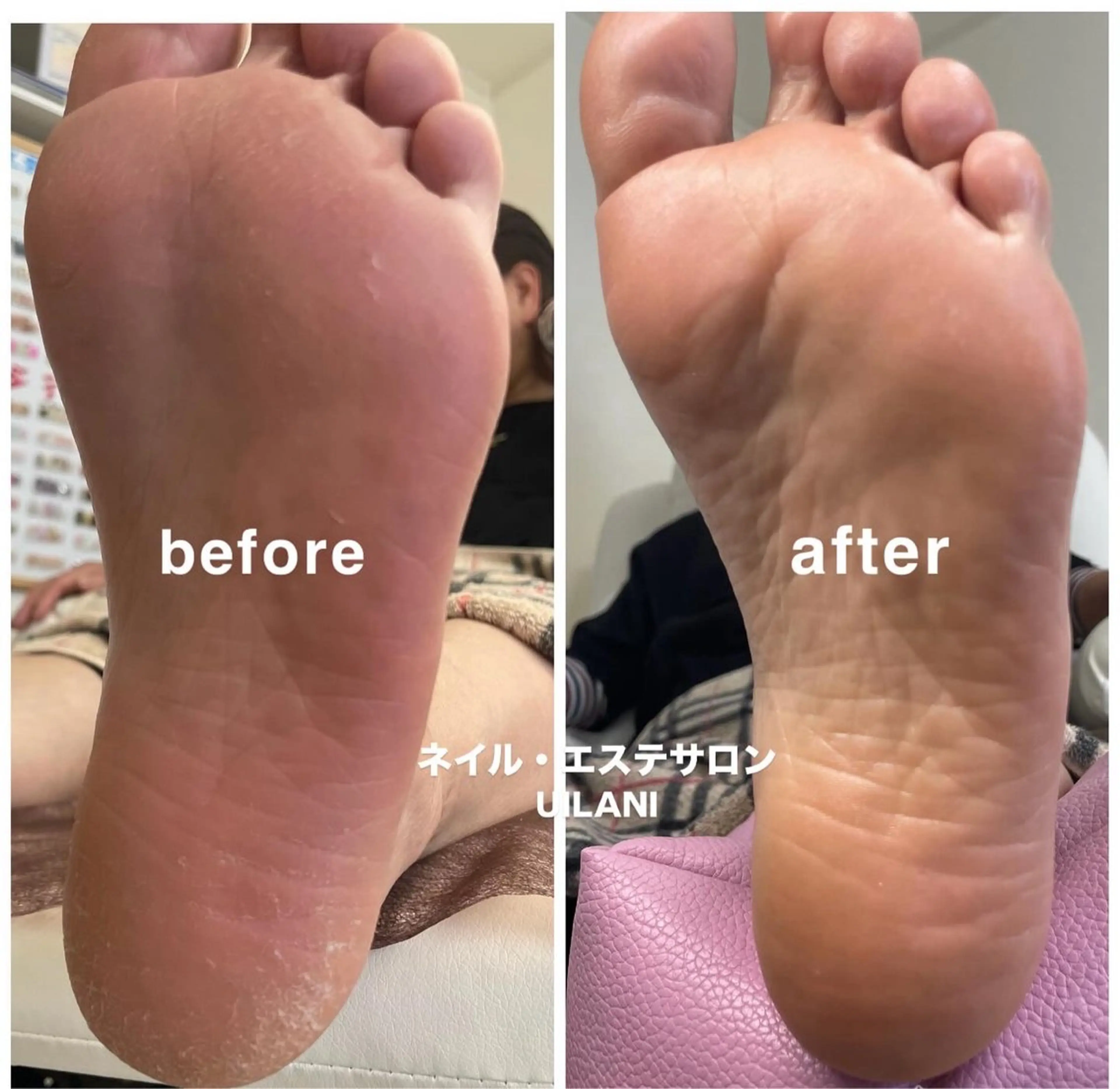 ネイル・エステサロンUILANI所属・ネイル・エステサロン UILANIのネイルデザイン