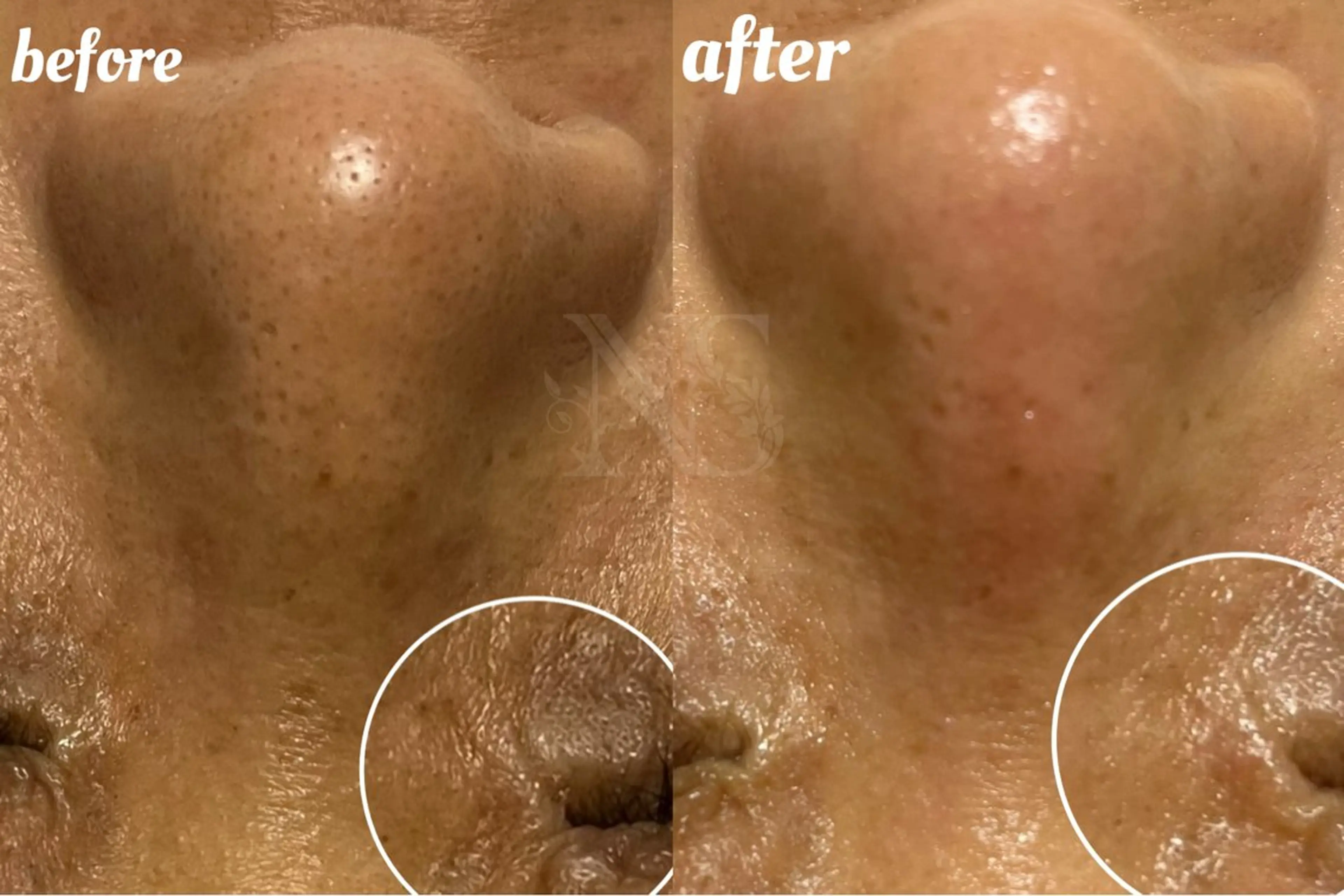 Nature Souce毛穴専門店のその他イメージ