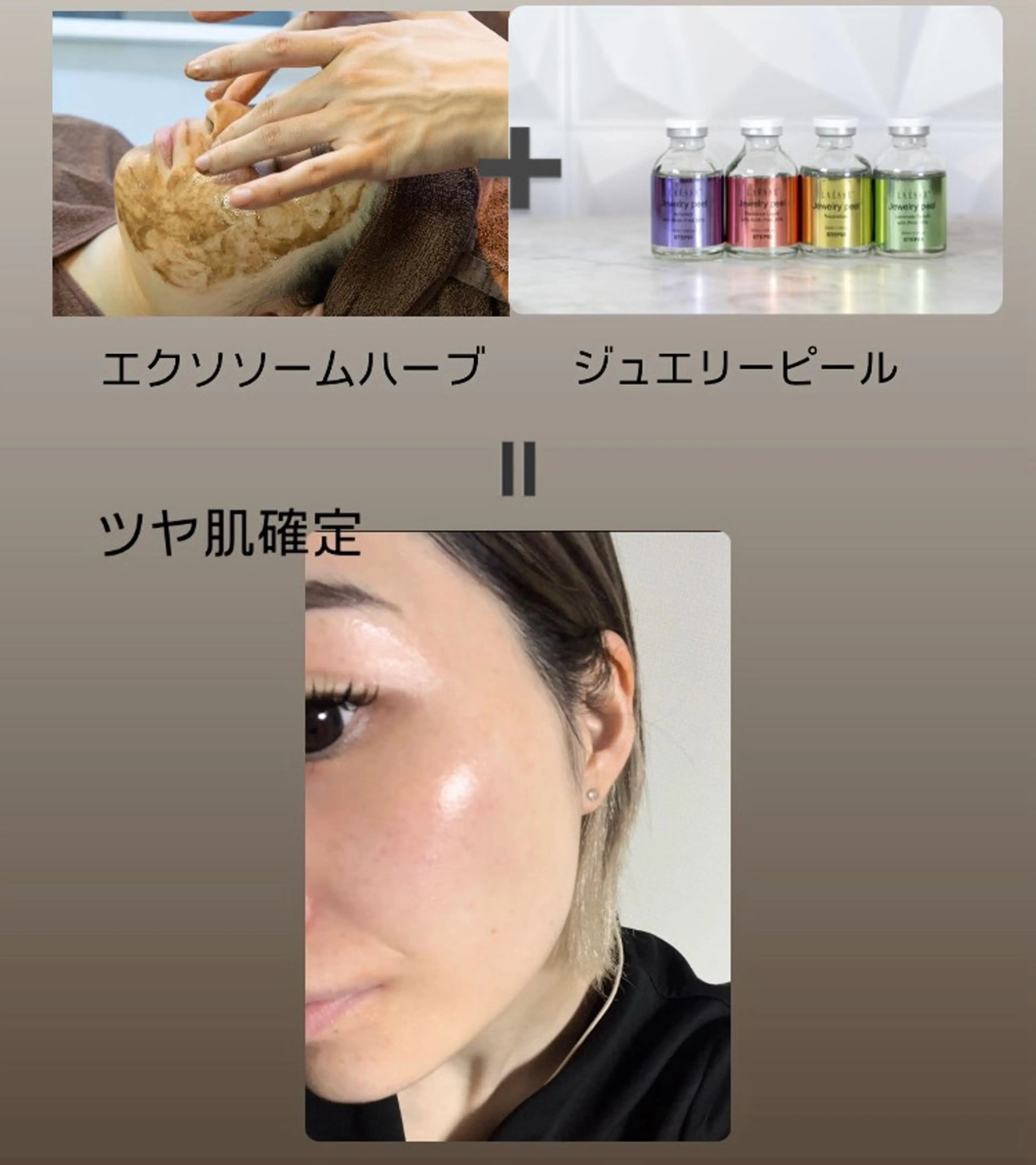 【2施術】美肌確定！ハーブピーリングメジュエリーピールの写真