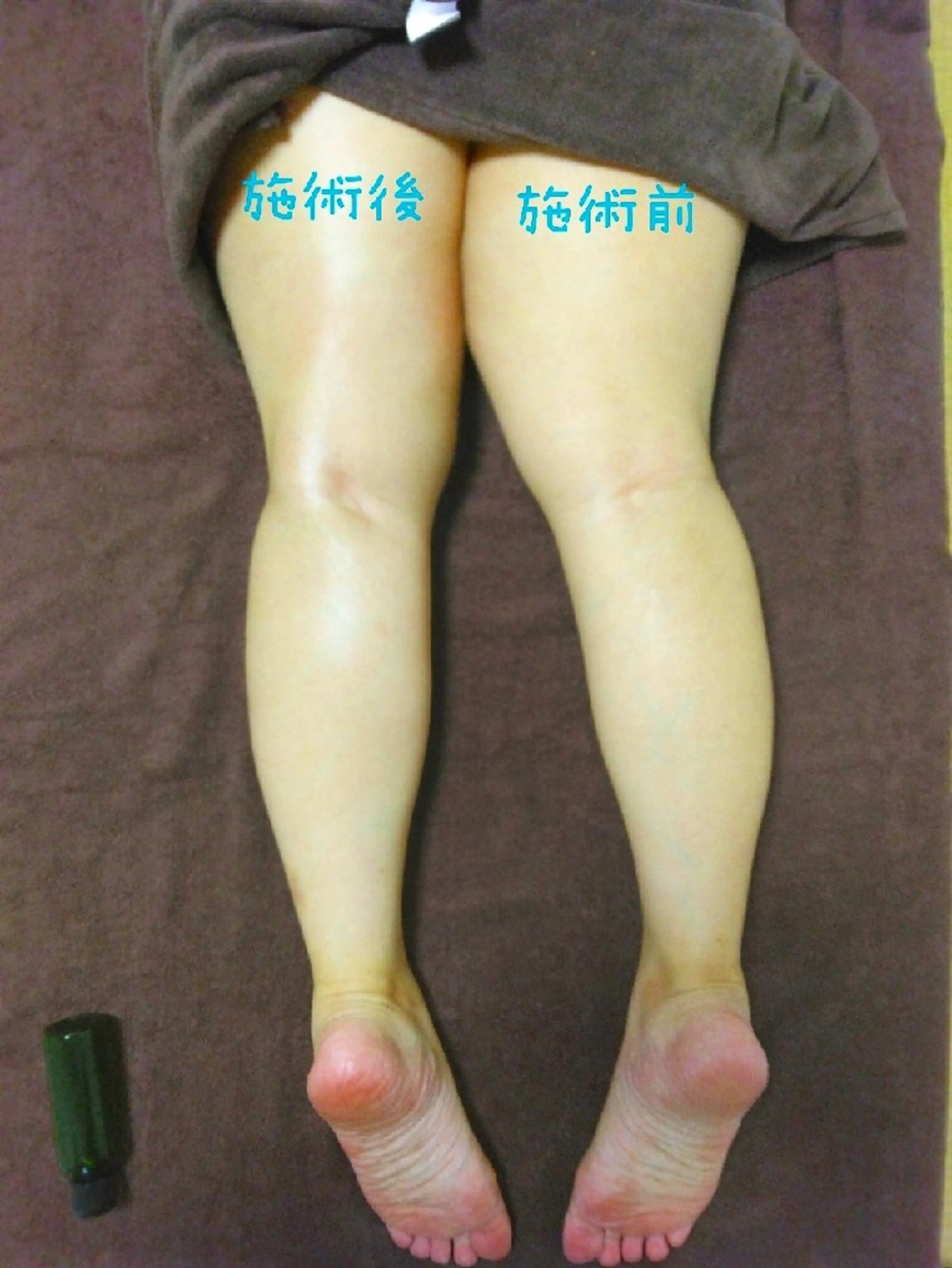 LOMILOMI Naoのエステ・リラクイメージ