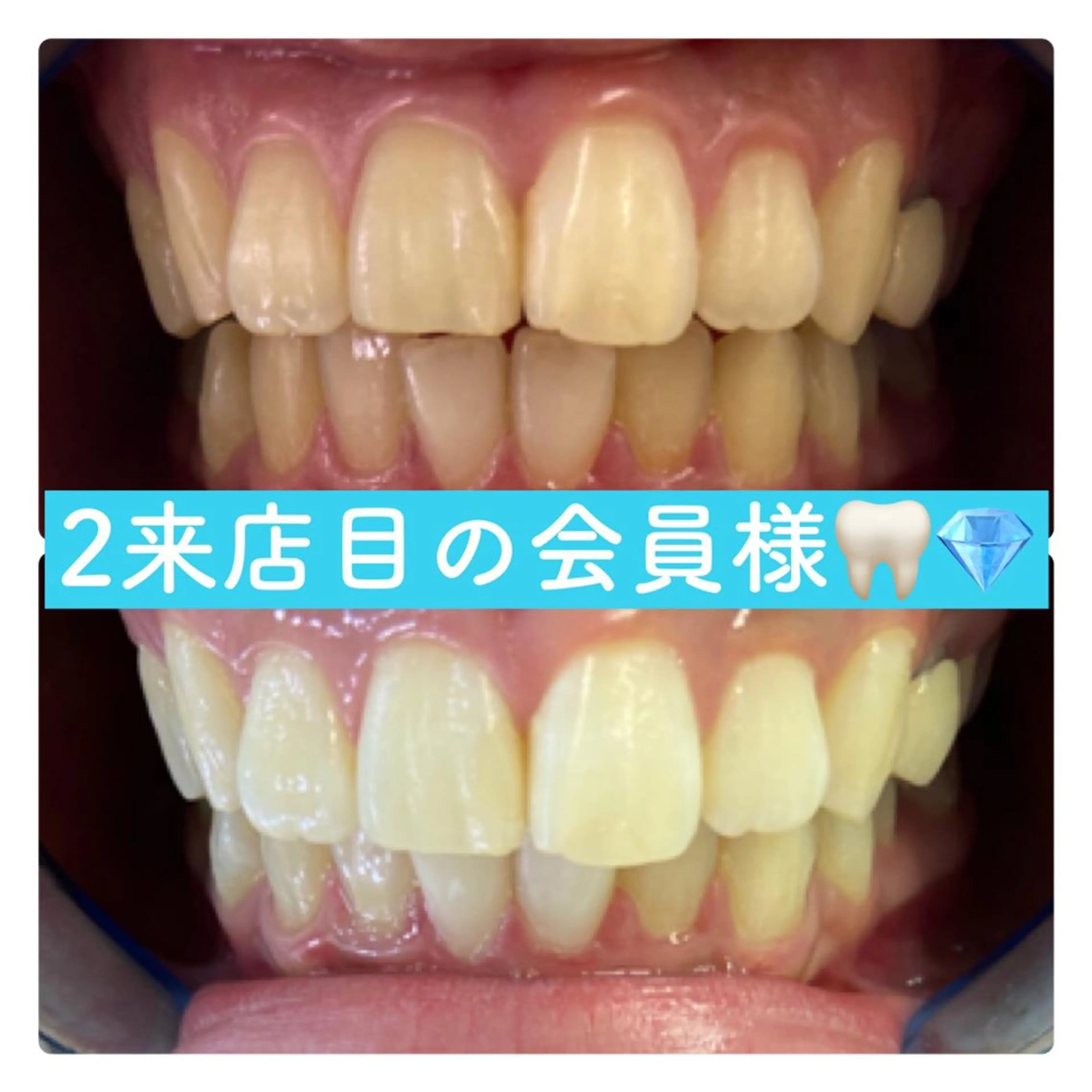 PLATINUM Beauty 横浜店所属・ホワイトニングルーム 横浜店のその他イメージ