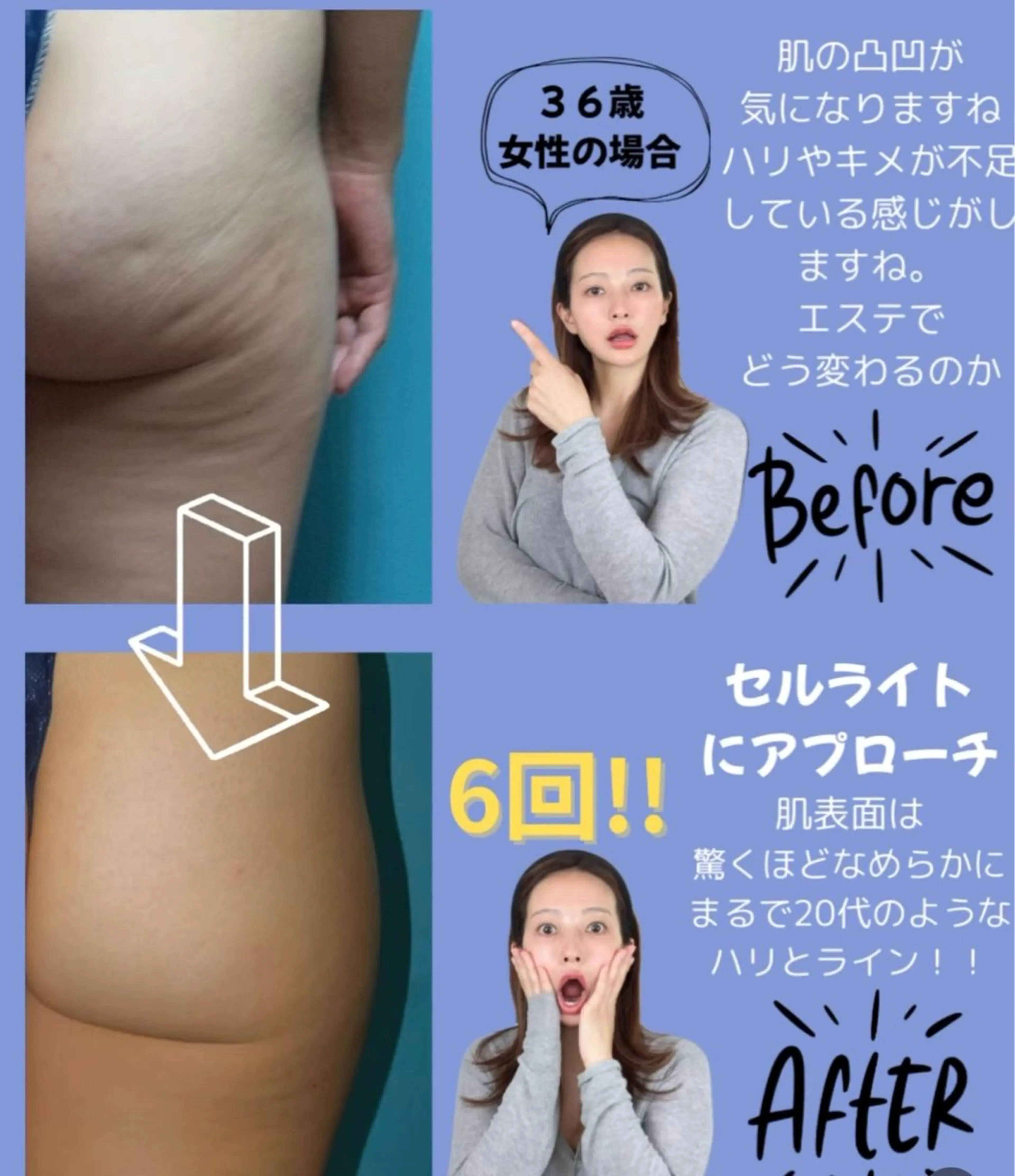 M.plus エムプリュ所属・よもぎ蒸し、セル撃退 専門店M.plusのエステ・リラクイメージ