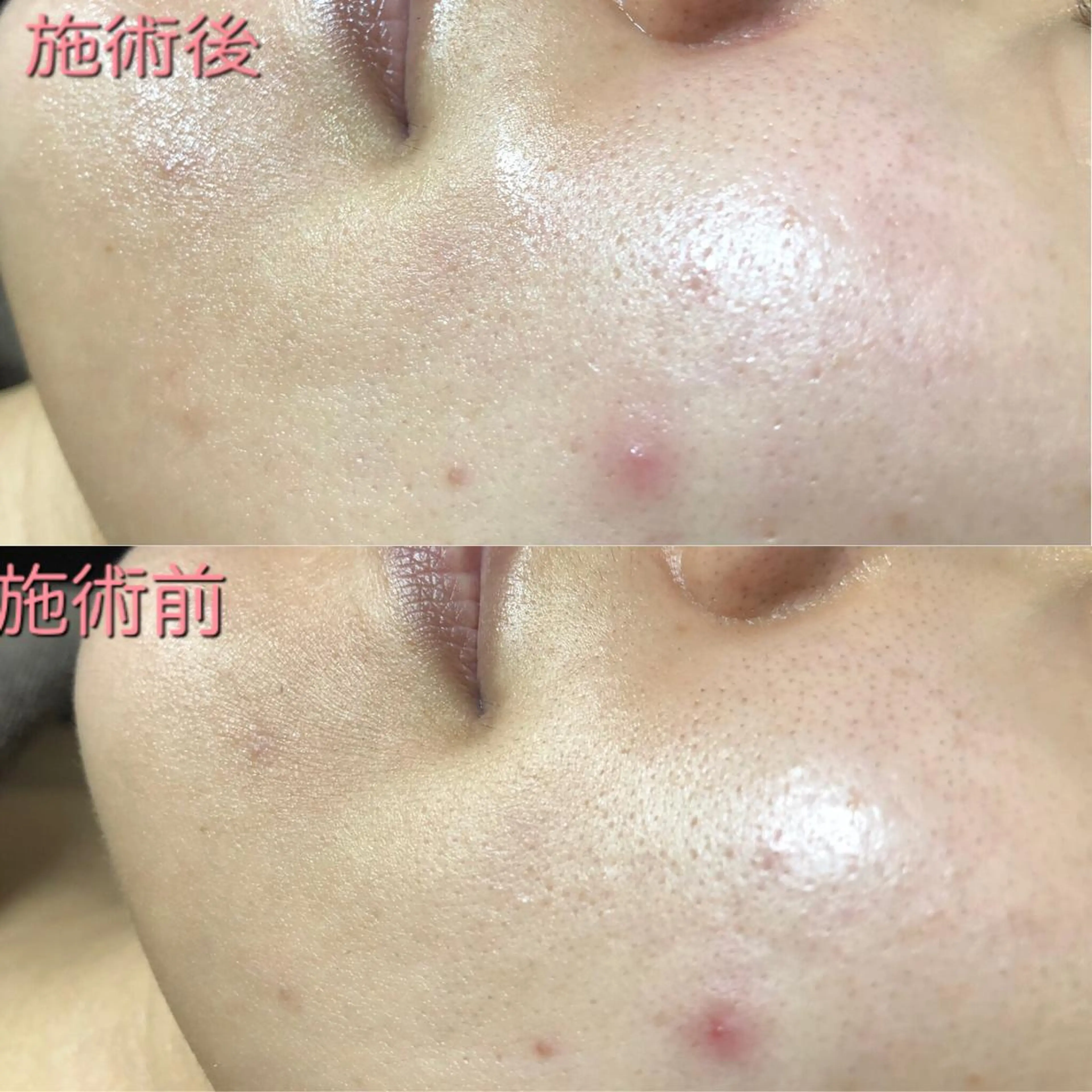 La.pport ラポールのエステ・リラクイメージ