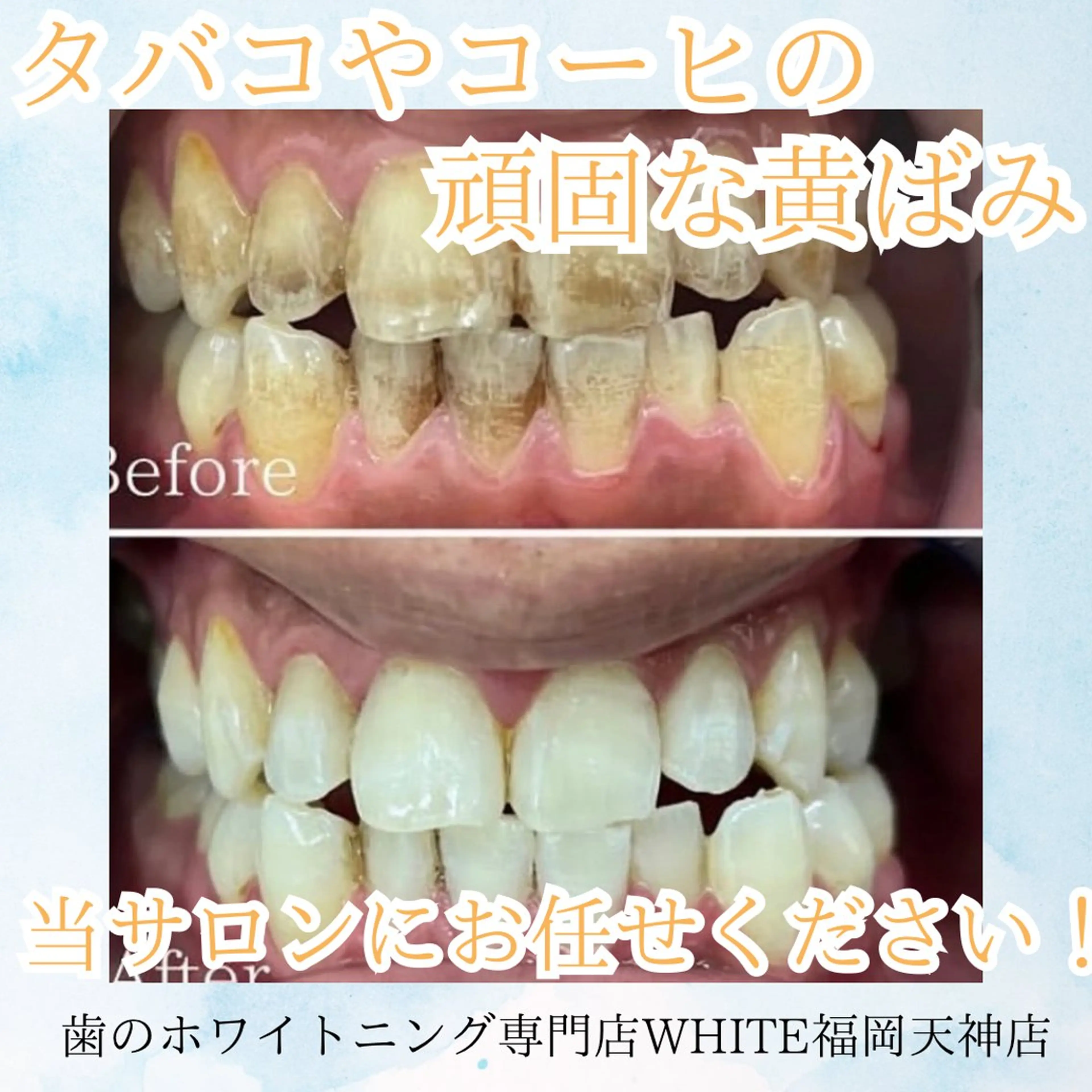 メンズ ホワイトニング専門店 WHITE天神店のエステ・リラクイメージ