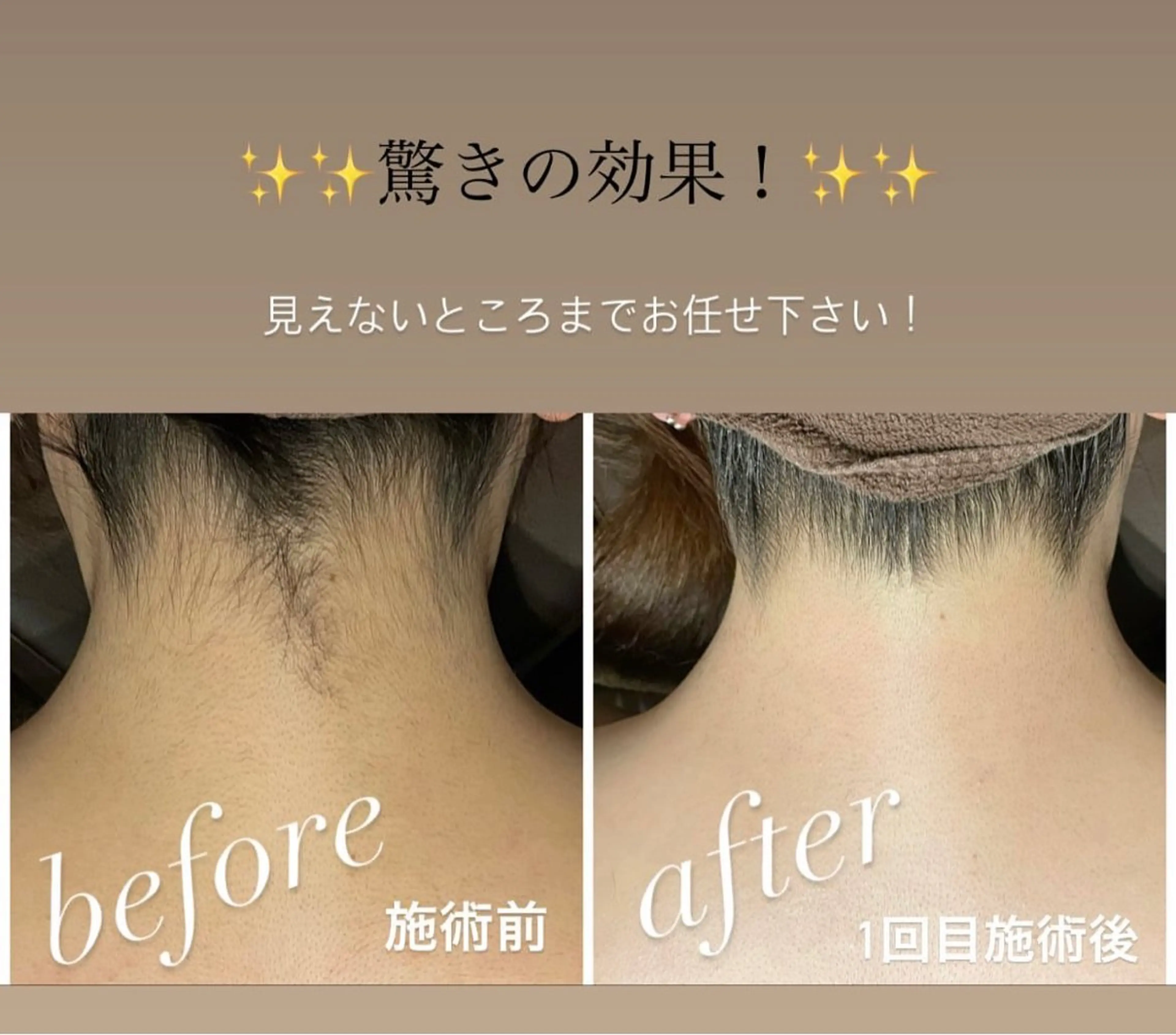 ヘアアレンジ メンズ キッズ 脱毛🌈Beauty Salon新宿店のエステ・リラクイメージ