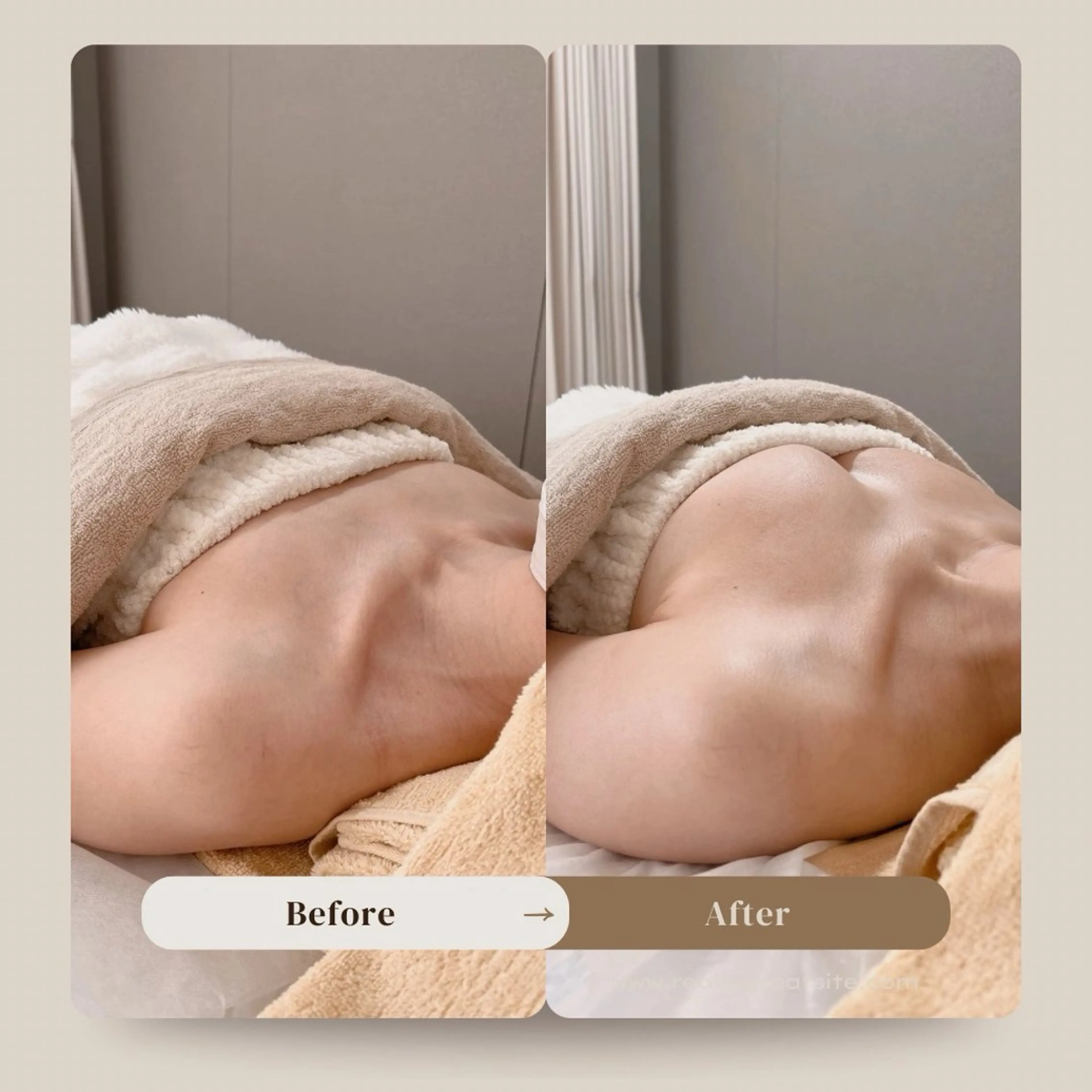 【5名限定SALE】バストケア体験!!の写真