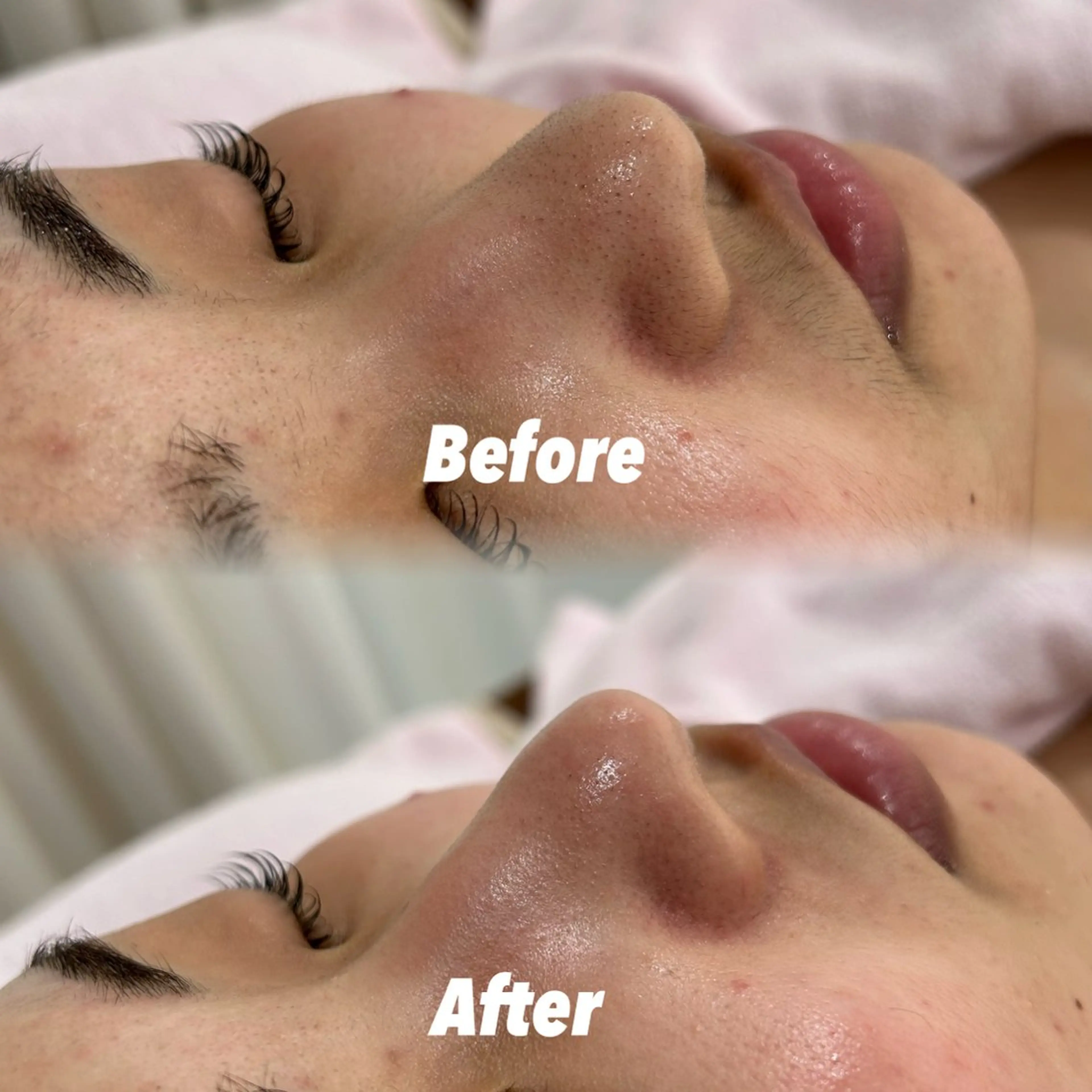 その他 🫧美しい素肌へ🫧 今成柚乃のその他イメージ