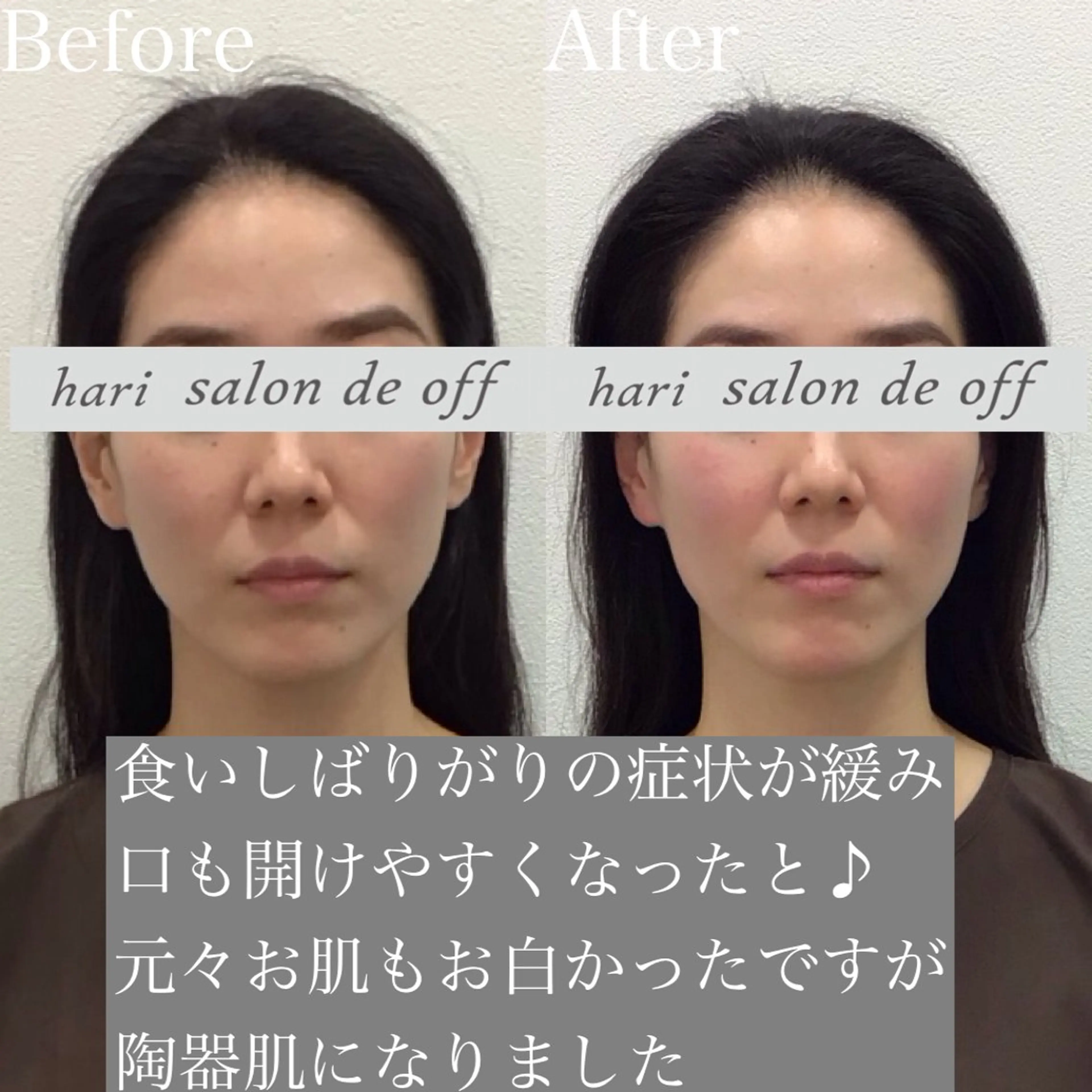 エステ リラク 整体×美容鍼灸 鍼灸師Miyanoのエステ・リラクイメージ