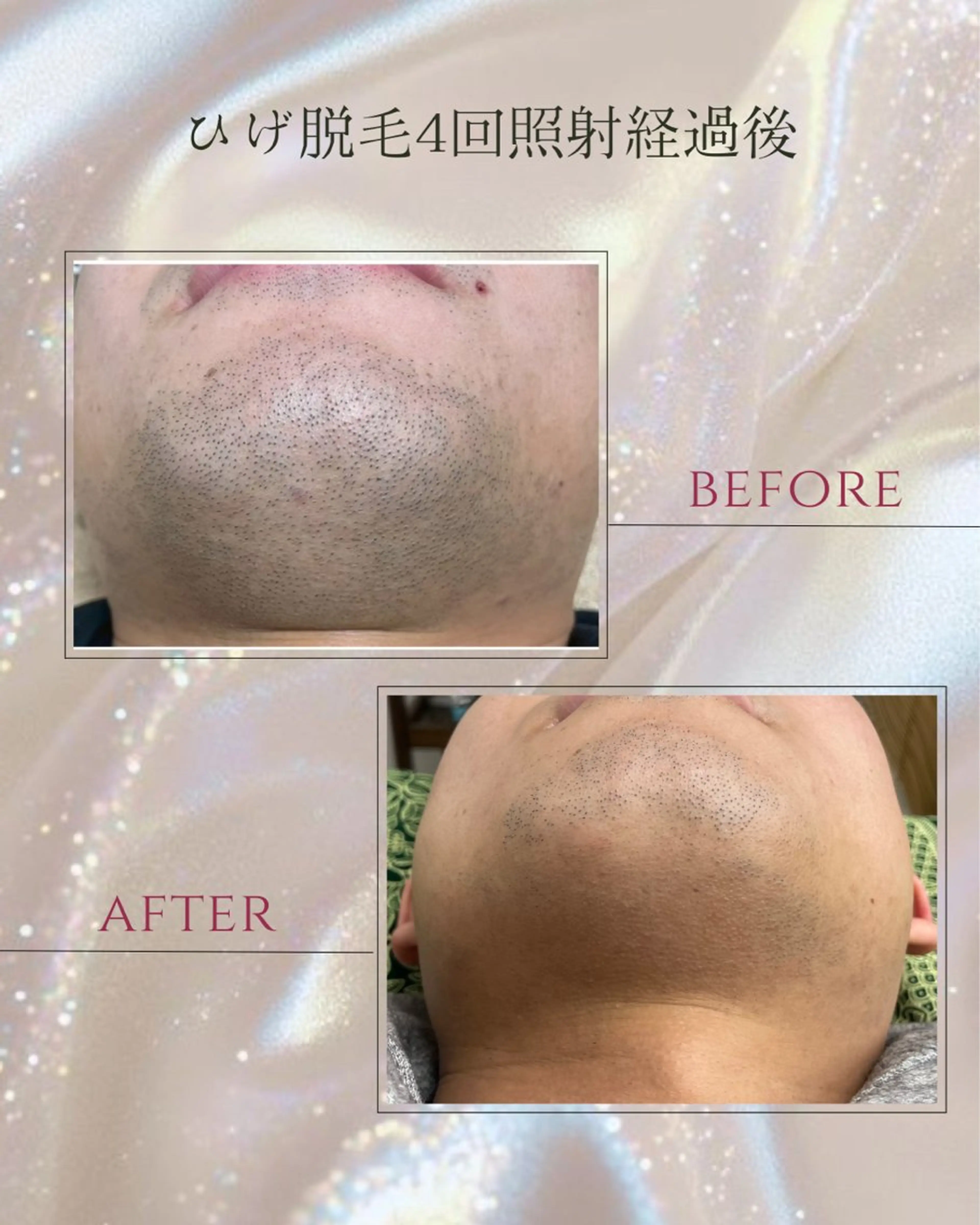 脱毛 DISINI  SPA所属・DISINISPA 脱毛/フェイシャルのエステ・リラクイメージ