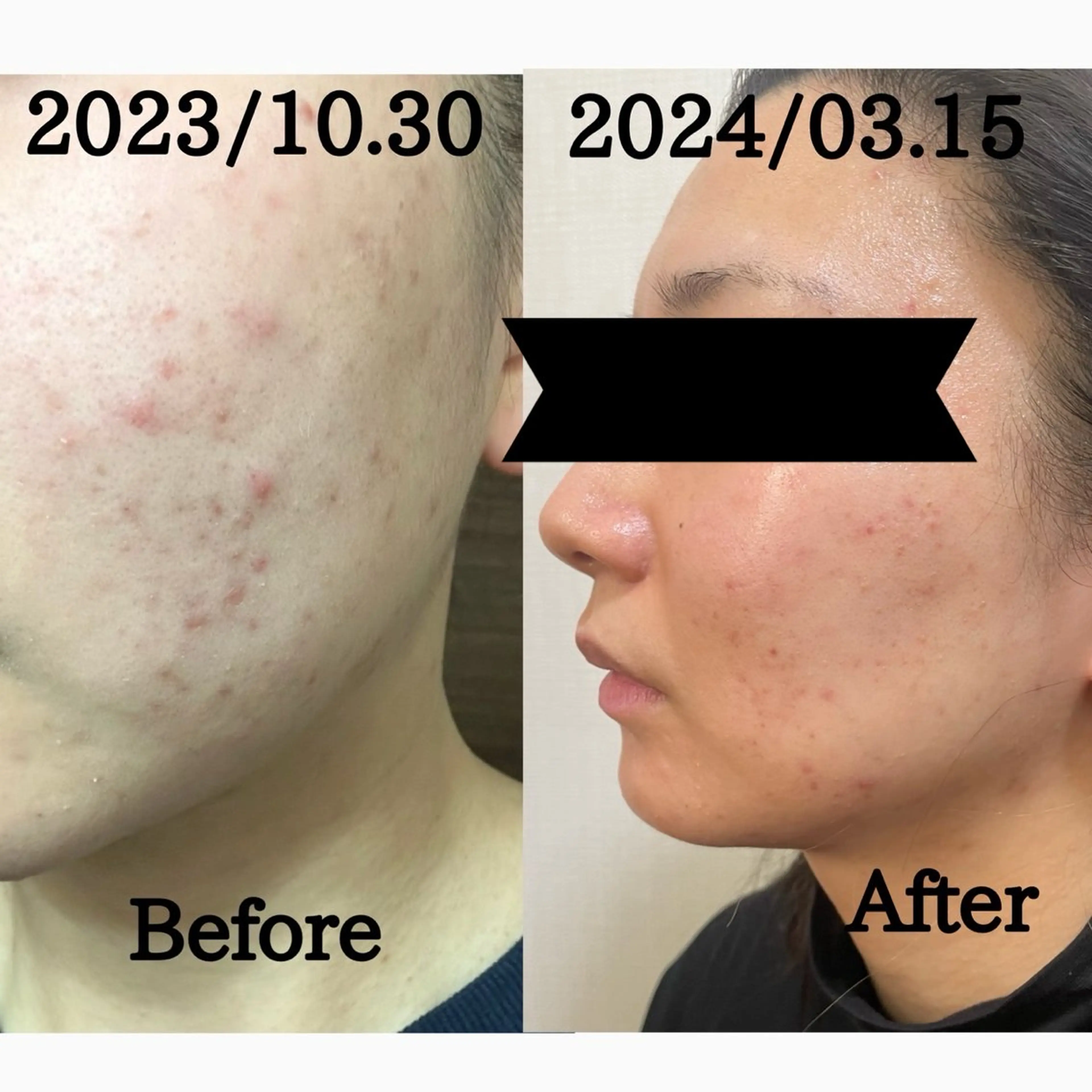 エステ リラク Surien 水脇ゆうのその他イメージ