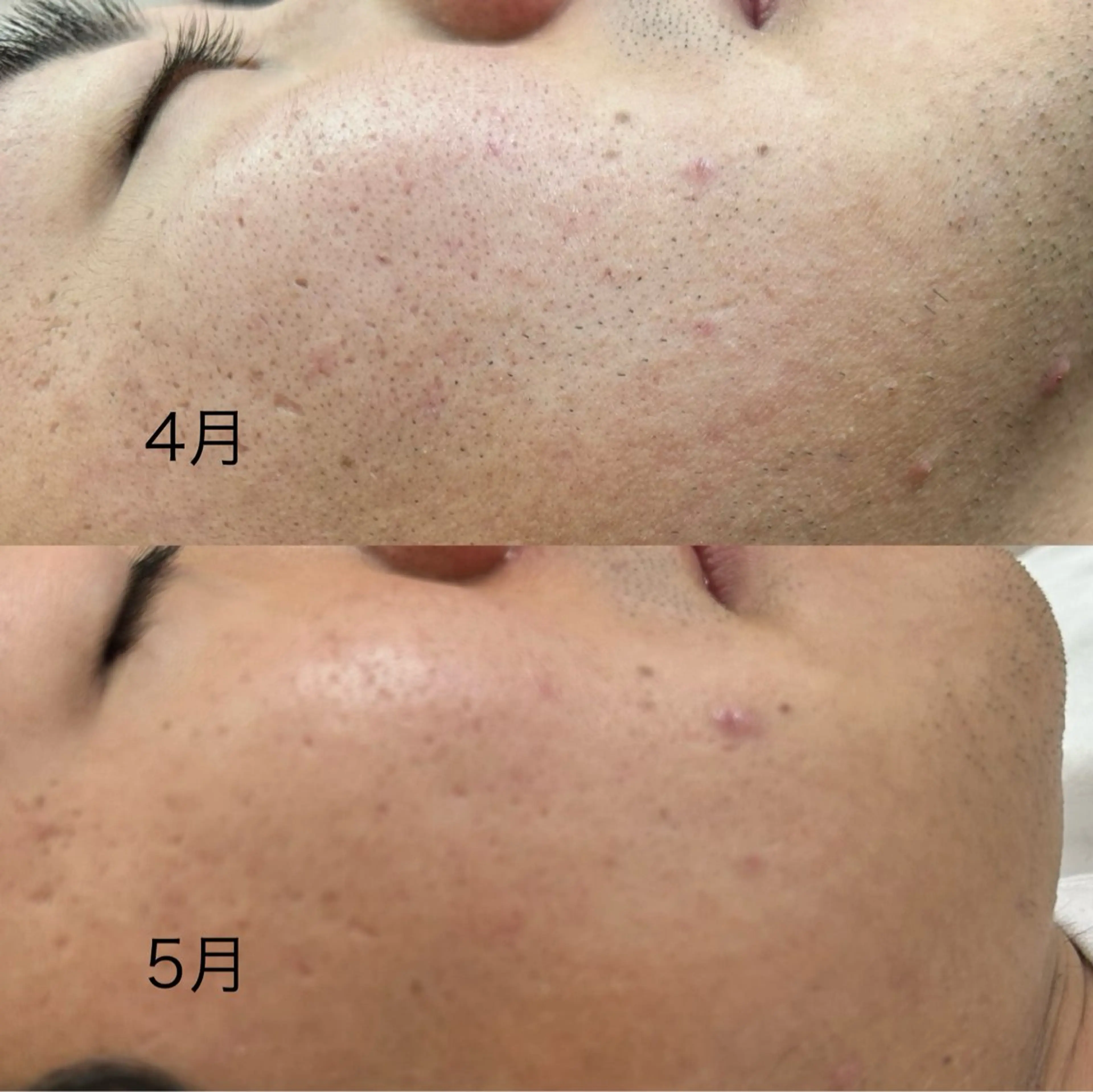 メンズ エステサロンMee. 大畑のエステ・リラクイメージ