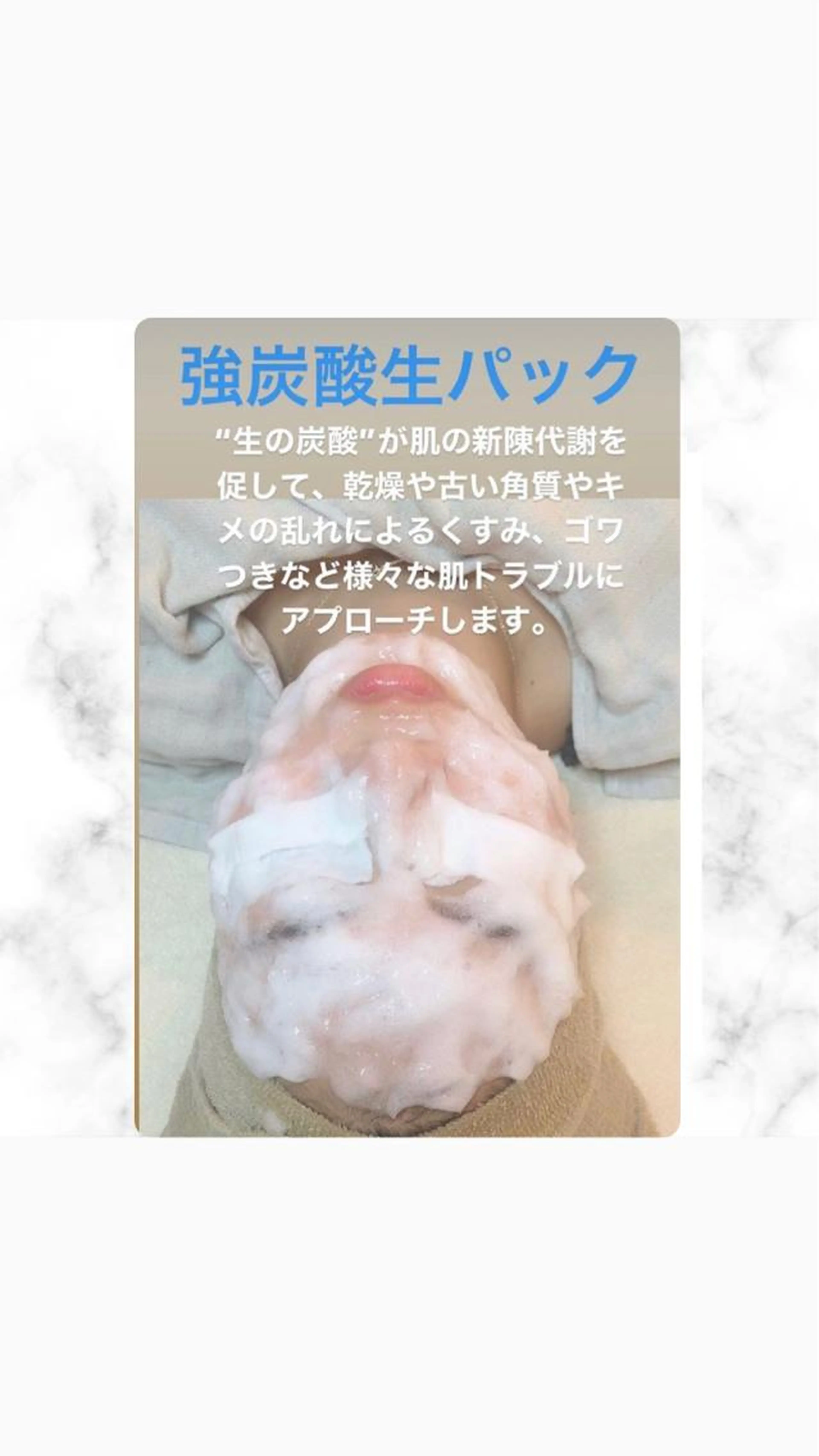 生炭酸パック＋美肌IPLフォトトリートメント！の写真