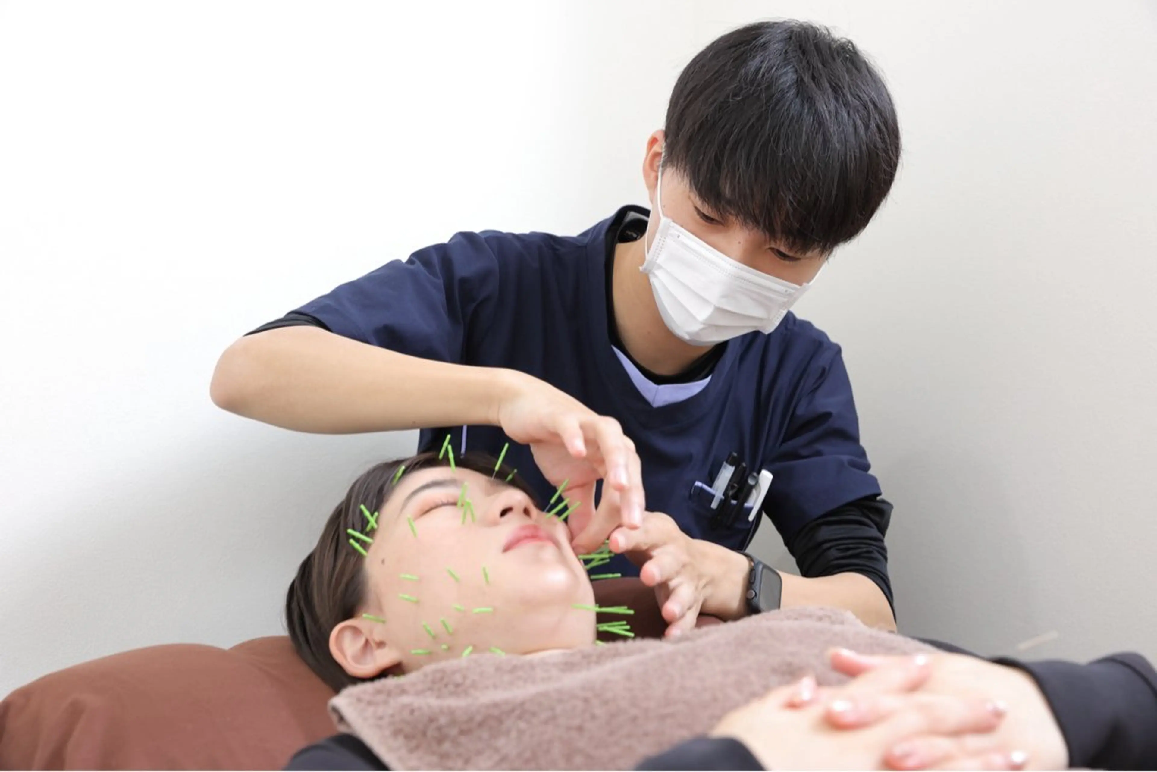 美容鍼(20本)　お試し体験の写真