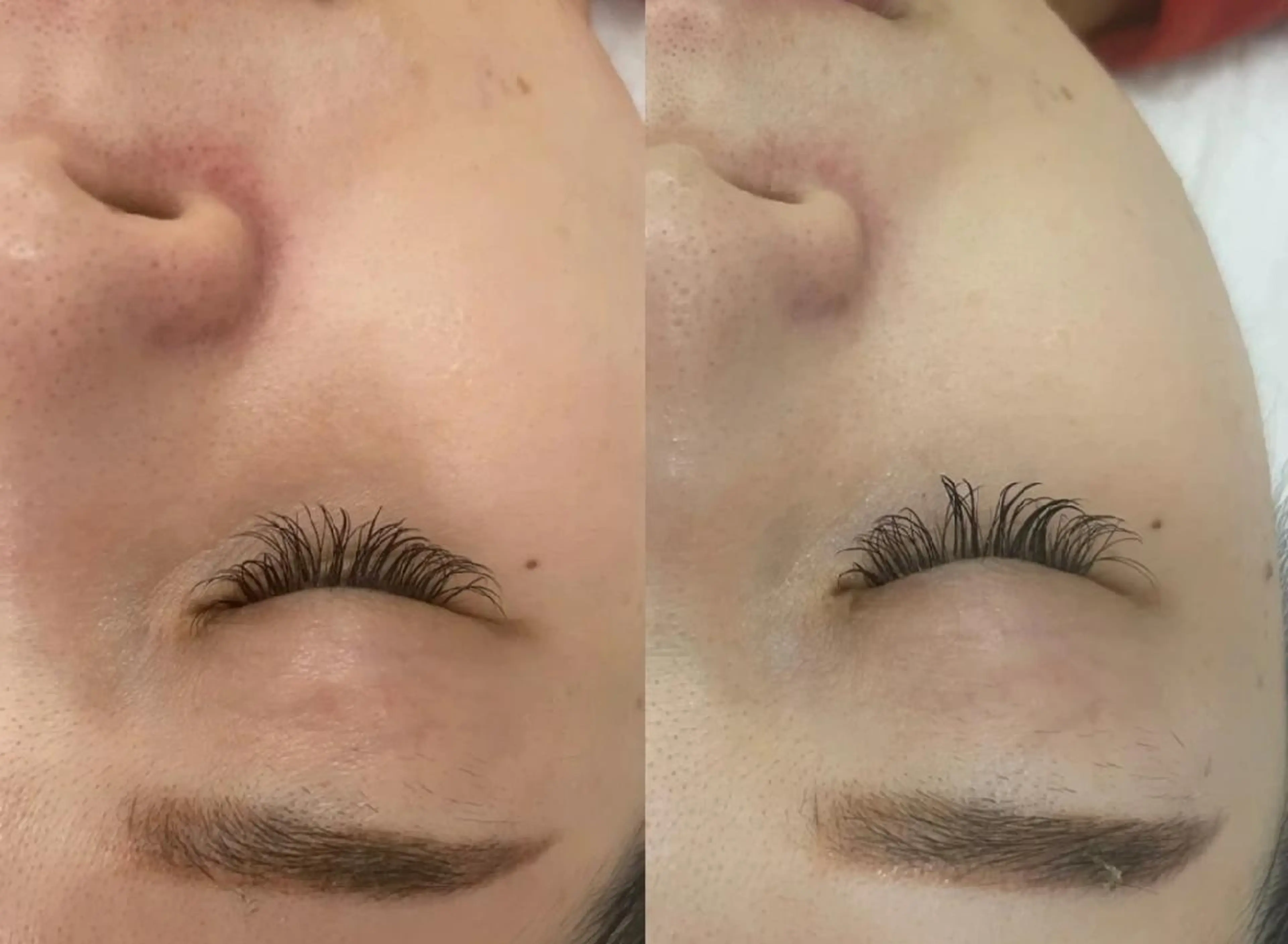 脱毛 aliaハイフ&水光ジェットサロン所属・aliaハーブ水光店 エステティシャン募集のエステ・リラクイメージ