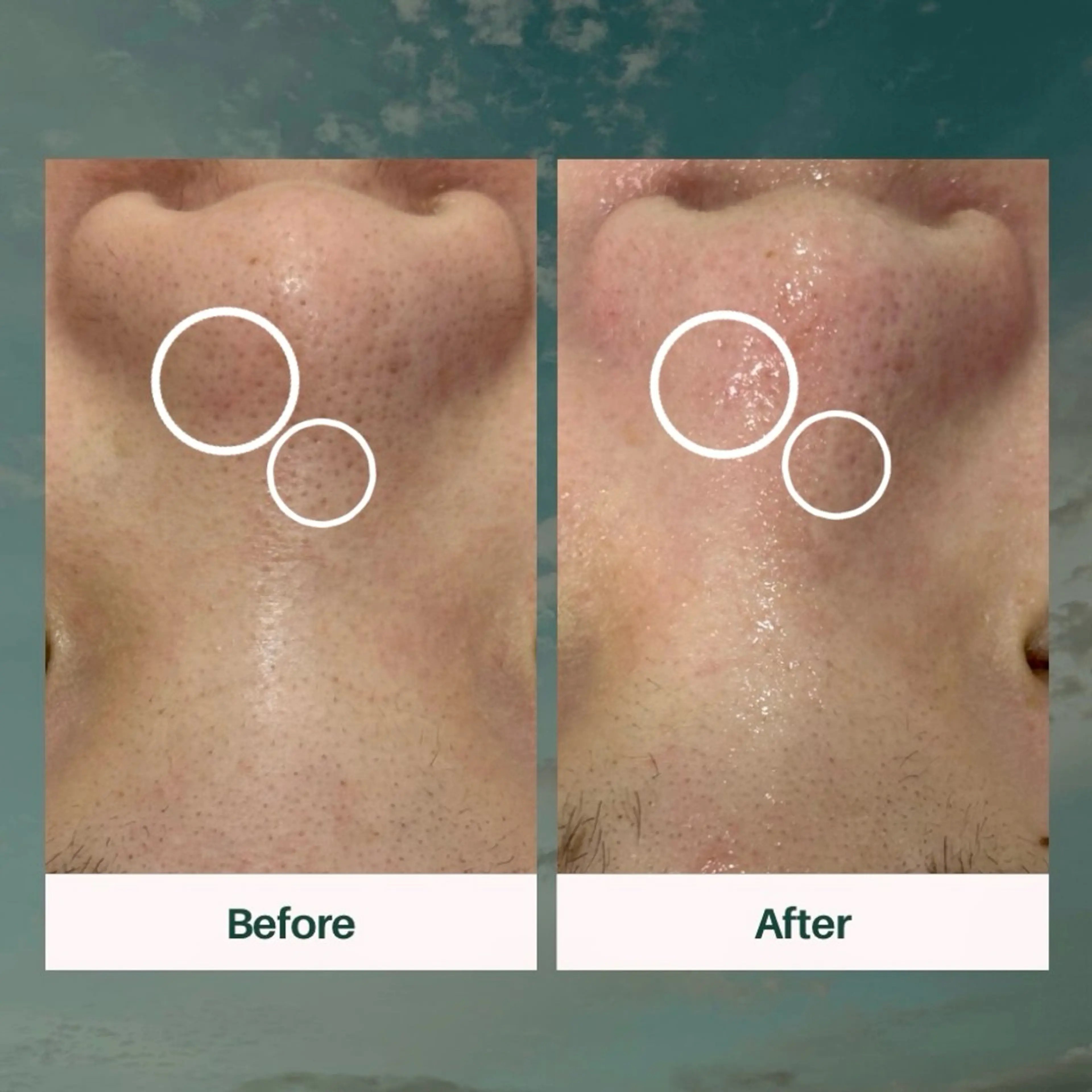 エステ AY'S所属・倉敷/玉島/20代 からの大人毛穴洗浄のエステ・リラクイメージ