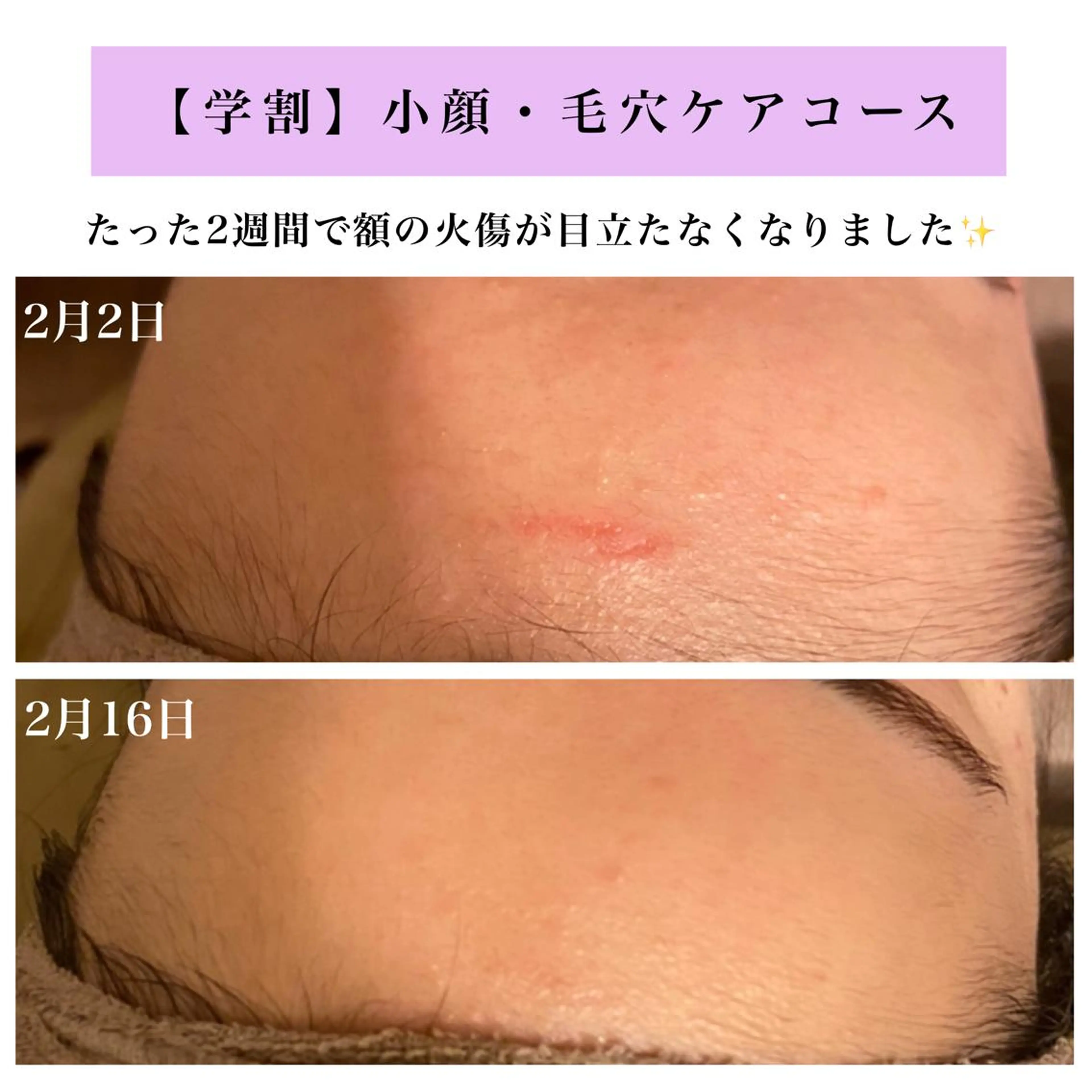 Bellesthe （ベルエステ）のエステ・リラクイメージ