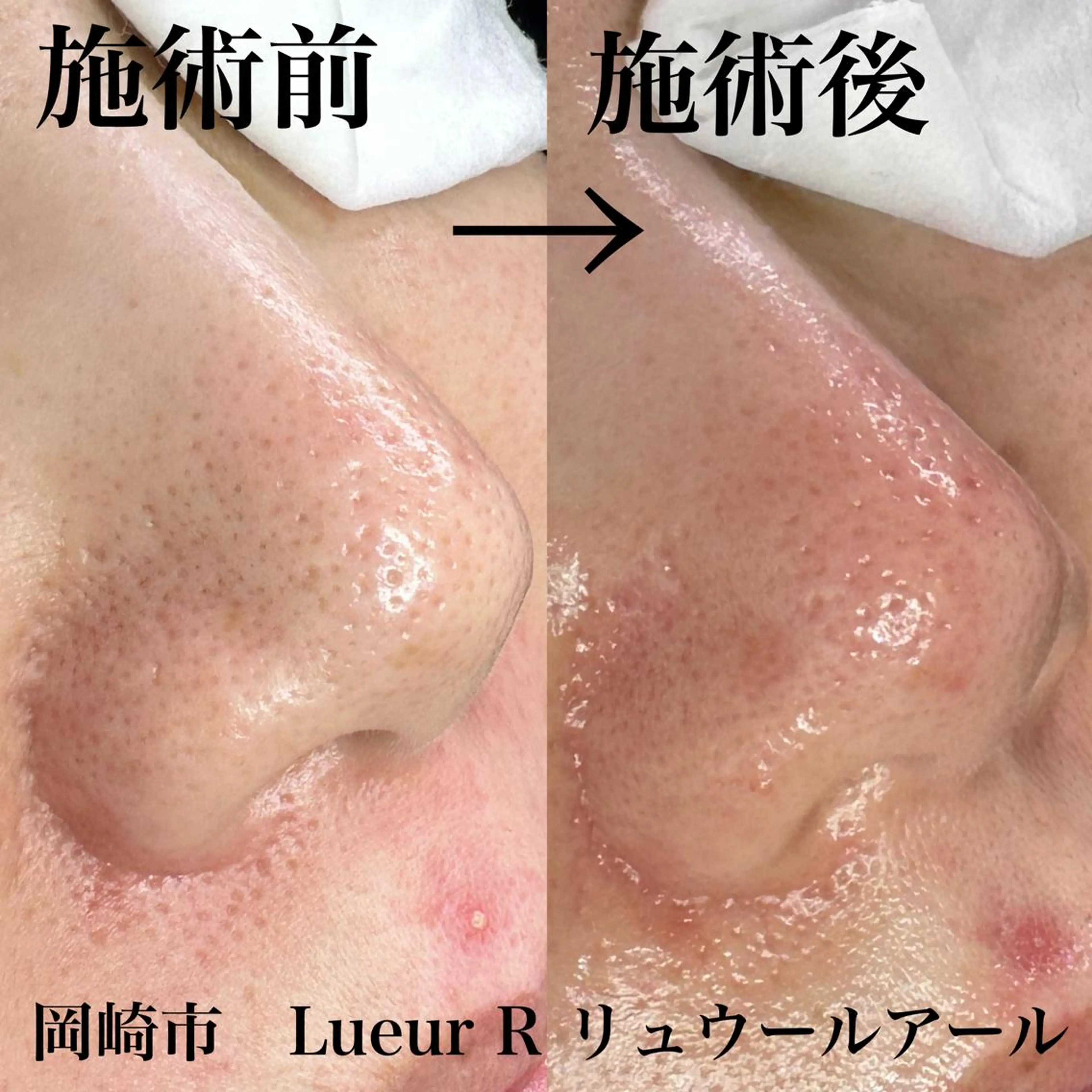 エステ 大久保 里奈のエステ・リラクイメージ