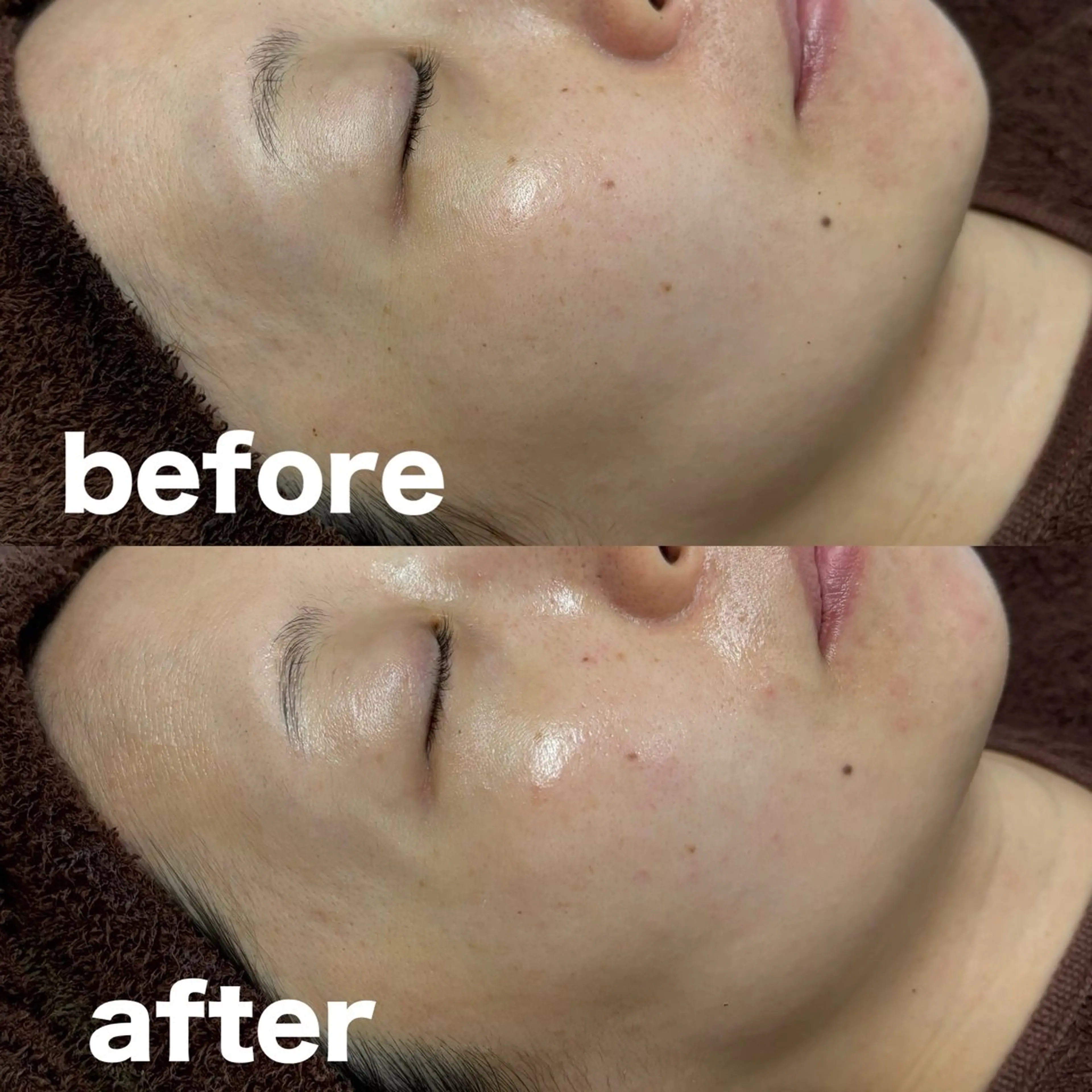 陶肌トリートメント(ハーブ2g)の写真