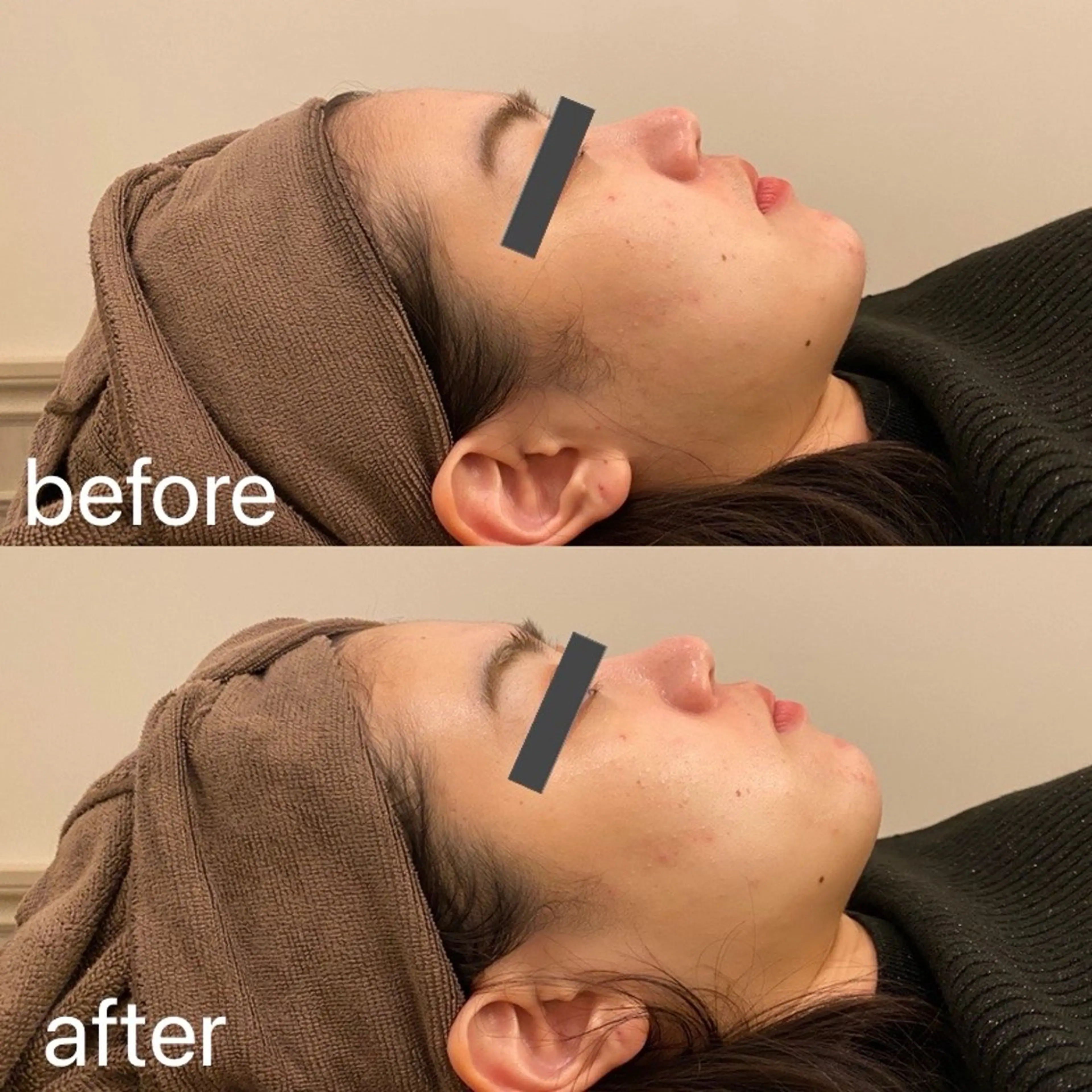 脱毛 Dione自由が丘 山下有香子のエステ・リラクイメージ