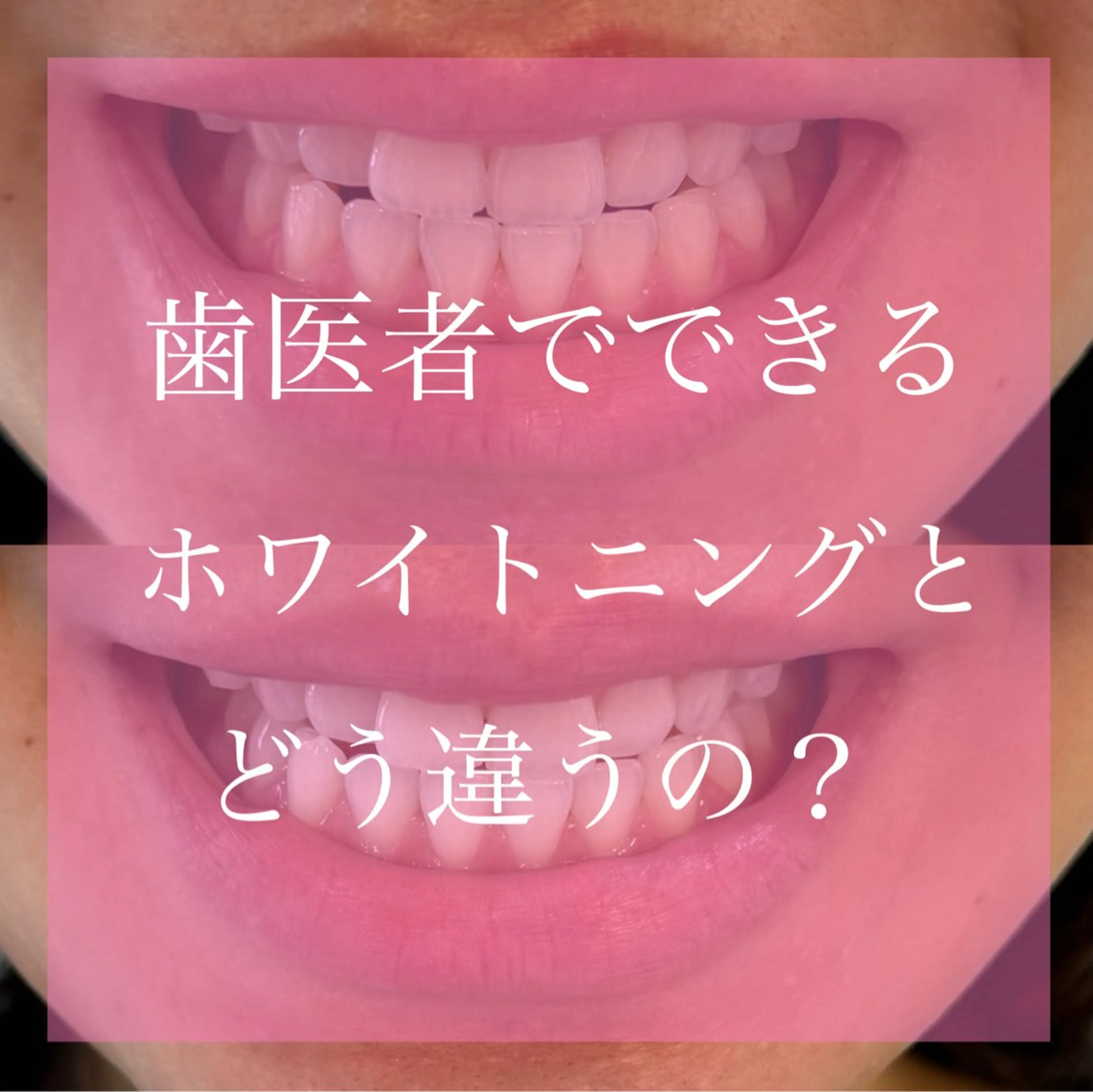 Livicate 💗🧁🎀🦋のマツエク・マツパデザイン