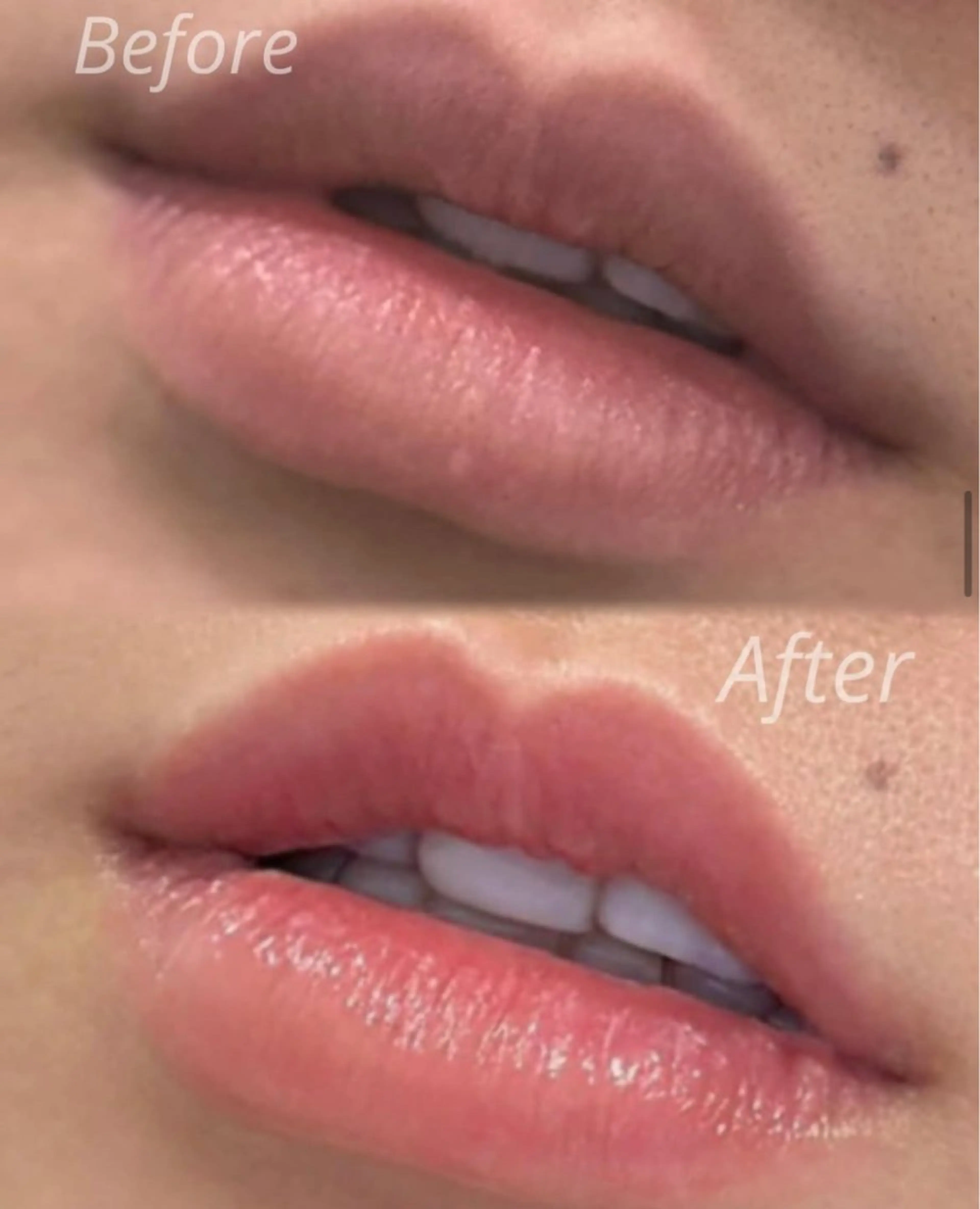 業界で話題！山梨初上陸🎀✨【ローマピンク💋】 唇¥150,000→¥90,000👀✨※アフタークリーム1本付🌸の写真